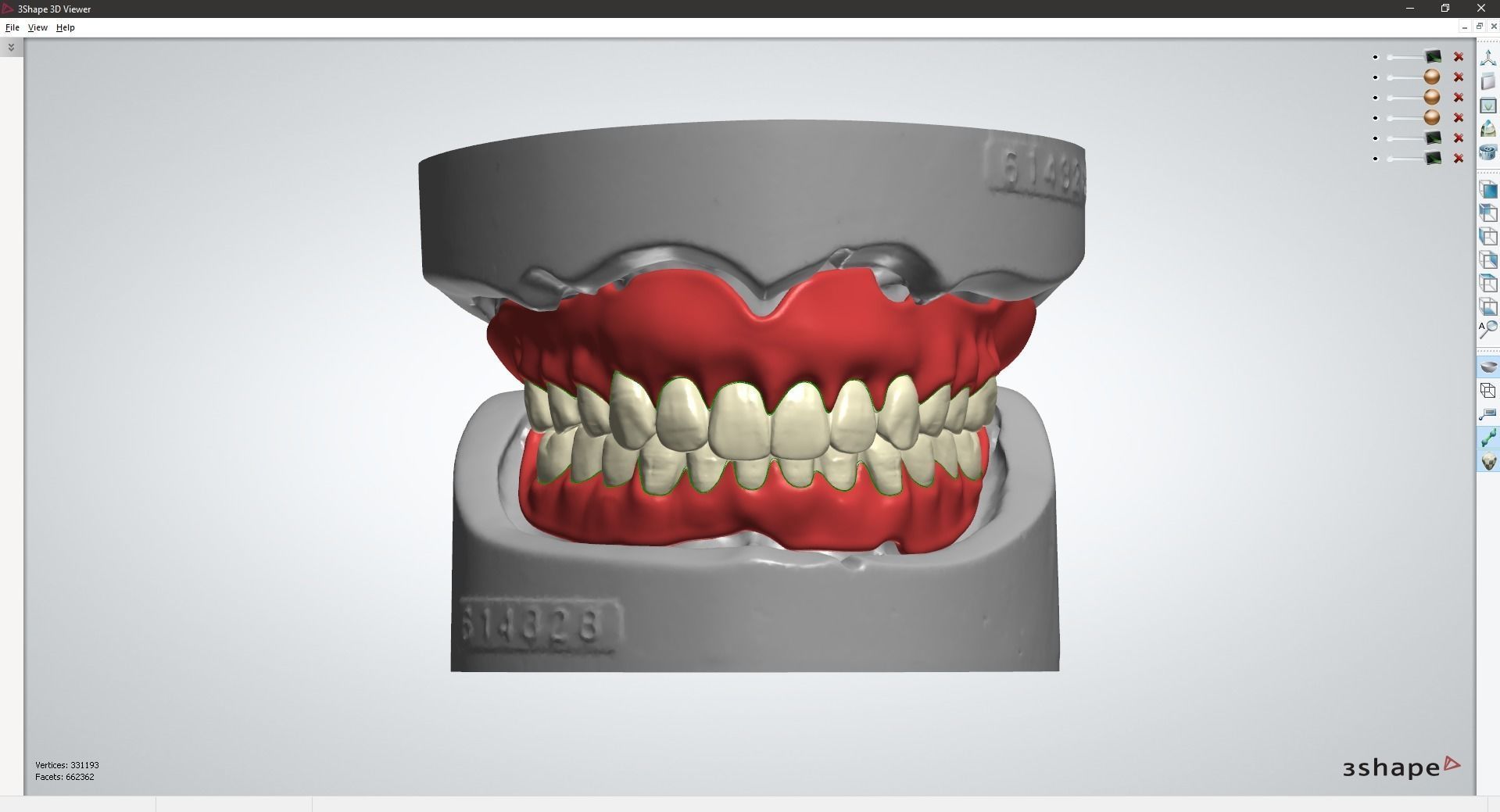 Digital Full Dentures with Combined Glue-in Teeth Arch 3D print model_8