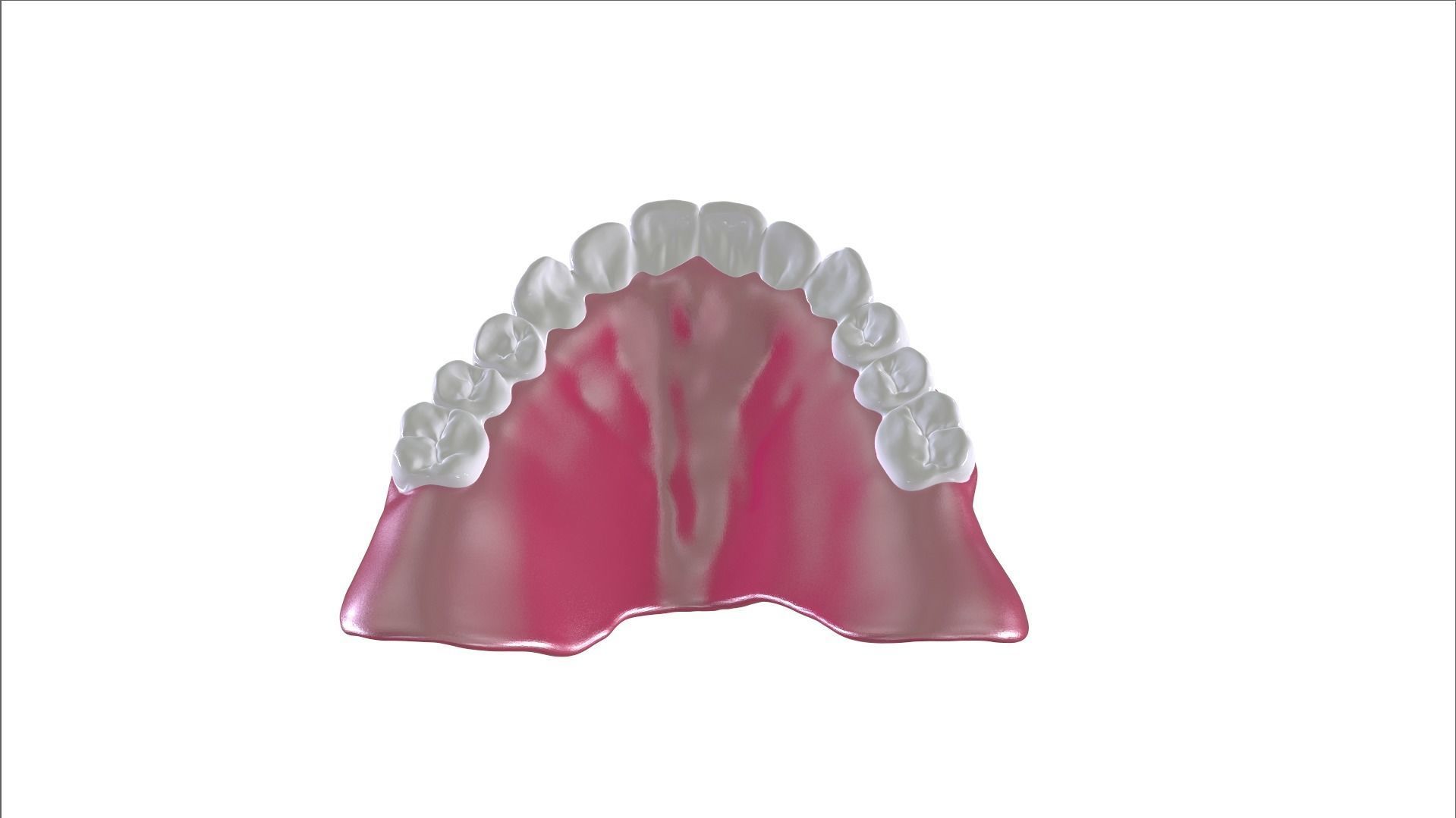 Digital Full Dentures with Combined Glue-in Teeth Arch 3D print model_22