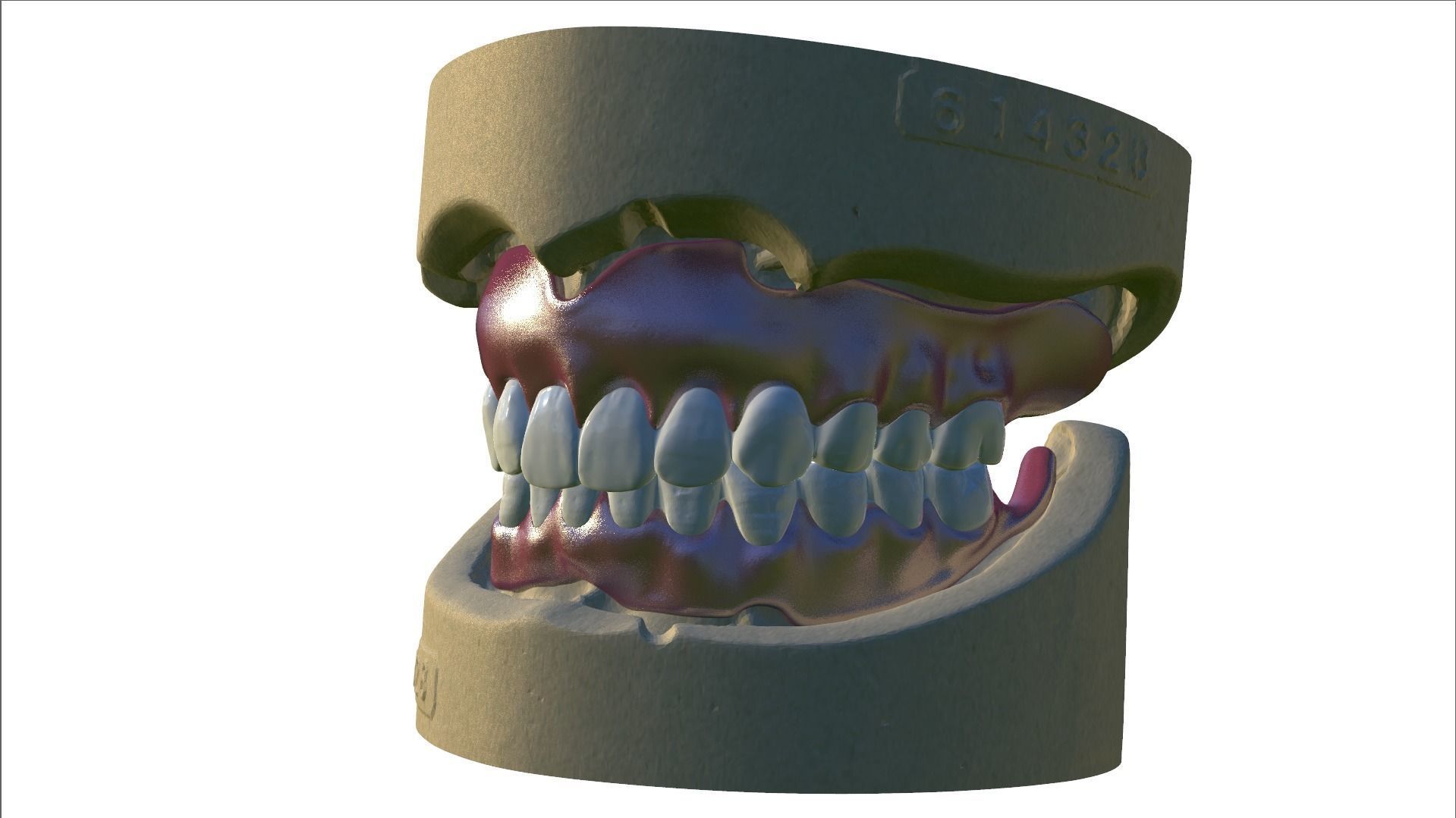 Digital Full Dentures with Combined Glue-in Teeth Arch 3D print model_10