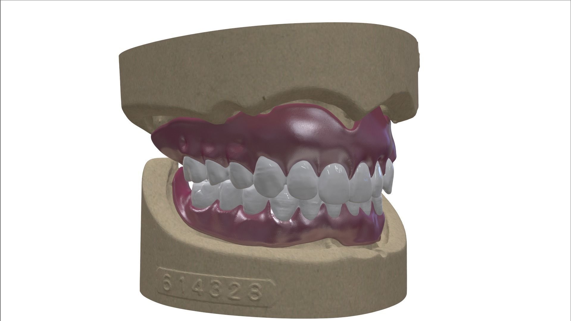 Digital Full Dentures with Combined Glue-in Teeth Arch 3D print model_7
