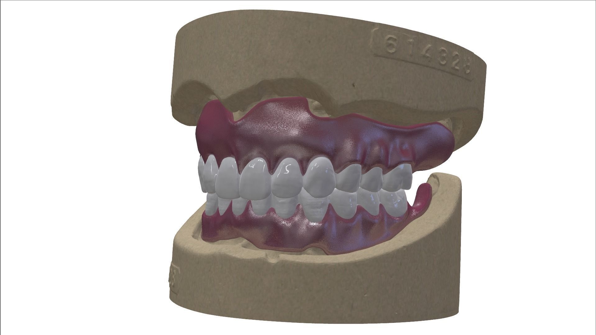 Digital Full Dentures with Combined Glue-in Teeth Arch 3D print model_11