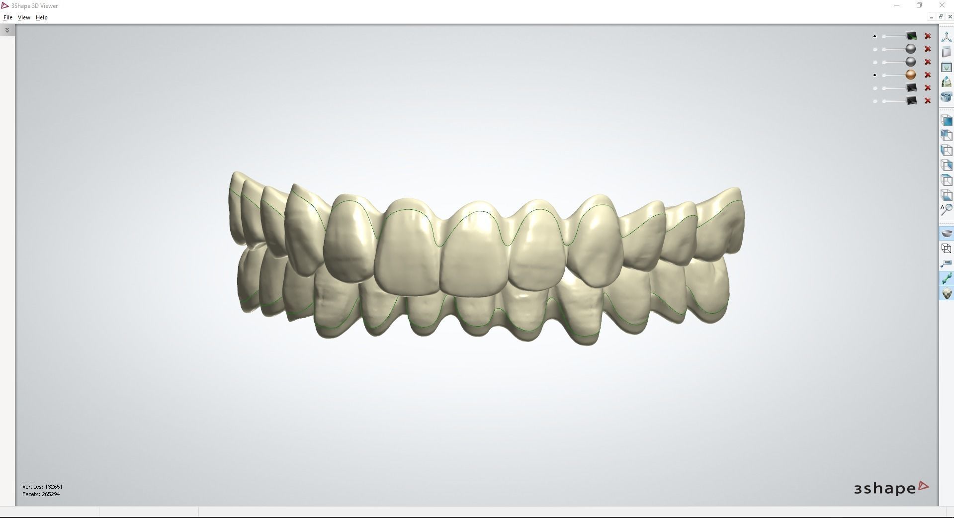 Digital Full Dentures with Combined Glue-in Teeth Arch 3D print model_12