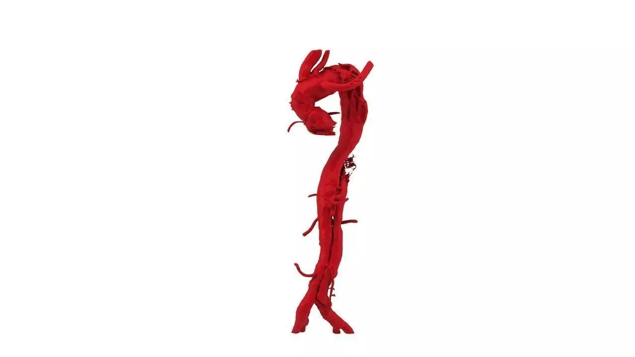 Aorta stick with thorns Free 3D print model