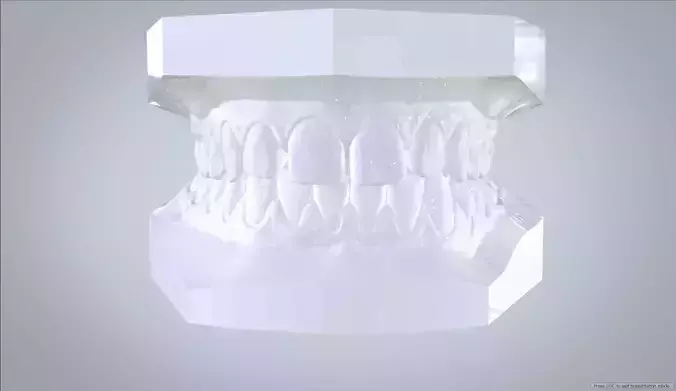 Orthodontic Planning Study Model 3D print model