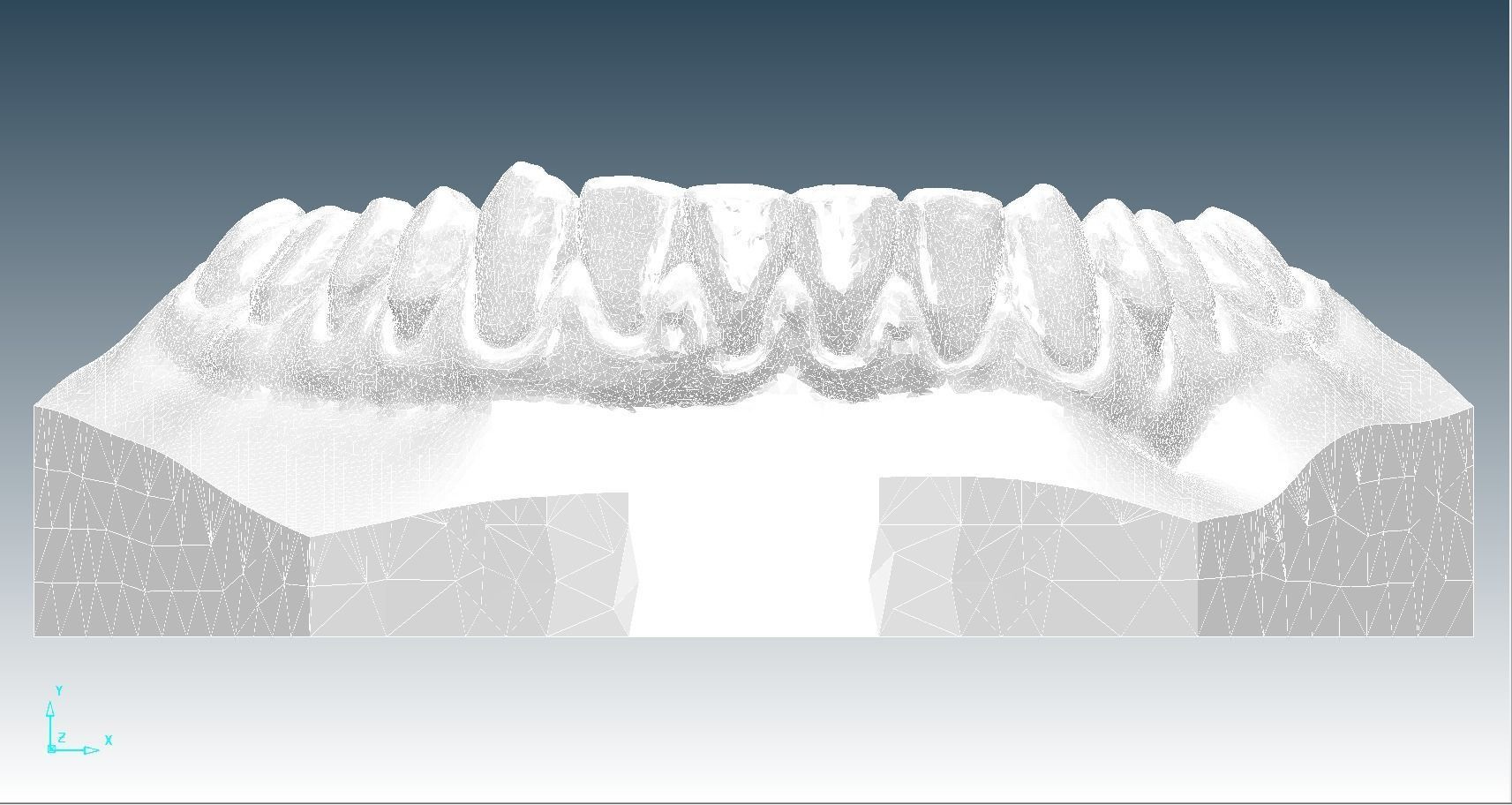 Orthodontic Planning Study Model 3D print model_16