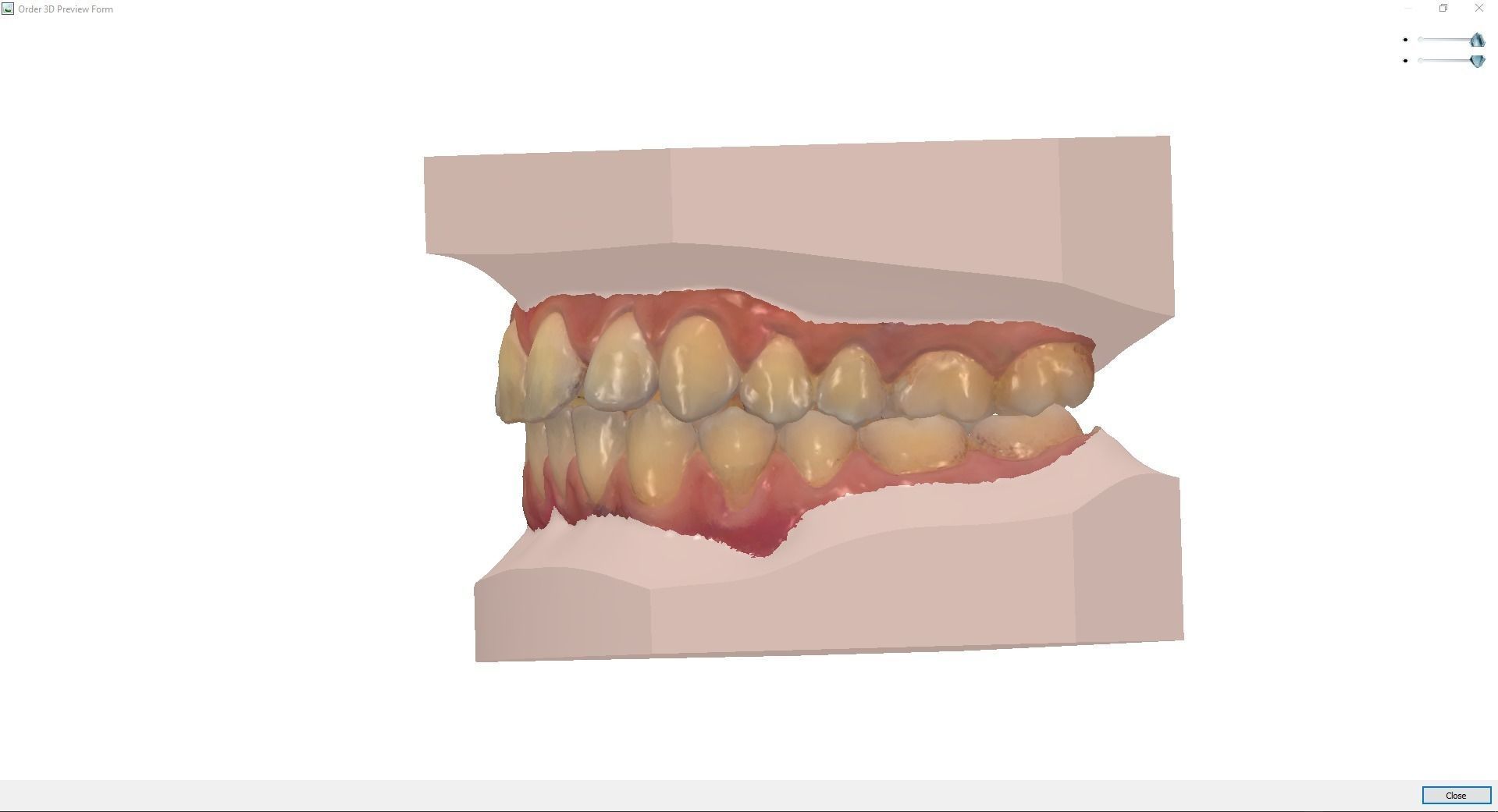 Orthodontic Planning Study Model 3D print model_12