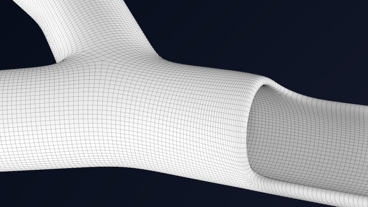 Artery with atherosclerotic plaque 3D model_24