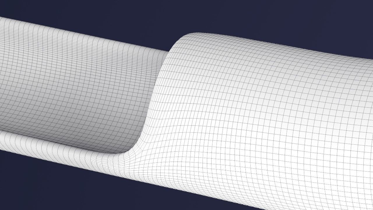 Artery with atherosclerotic plaque 3D model_5