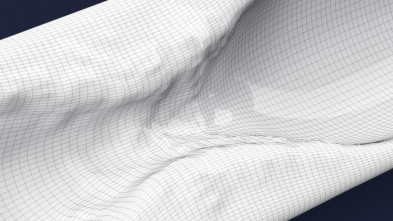 Artery with atherosclerotic plaque 3D model_17