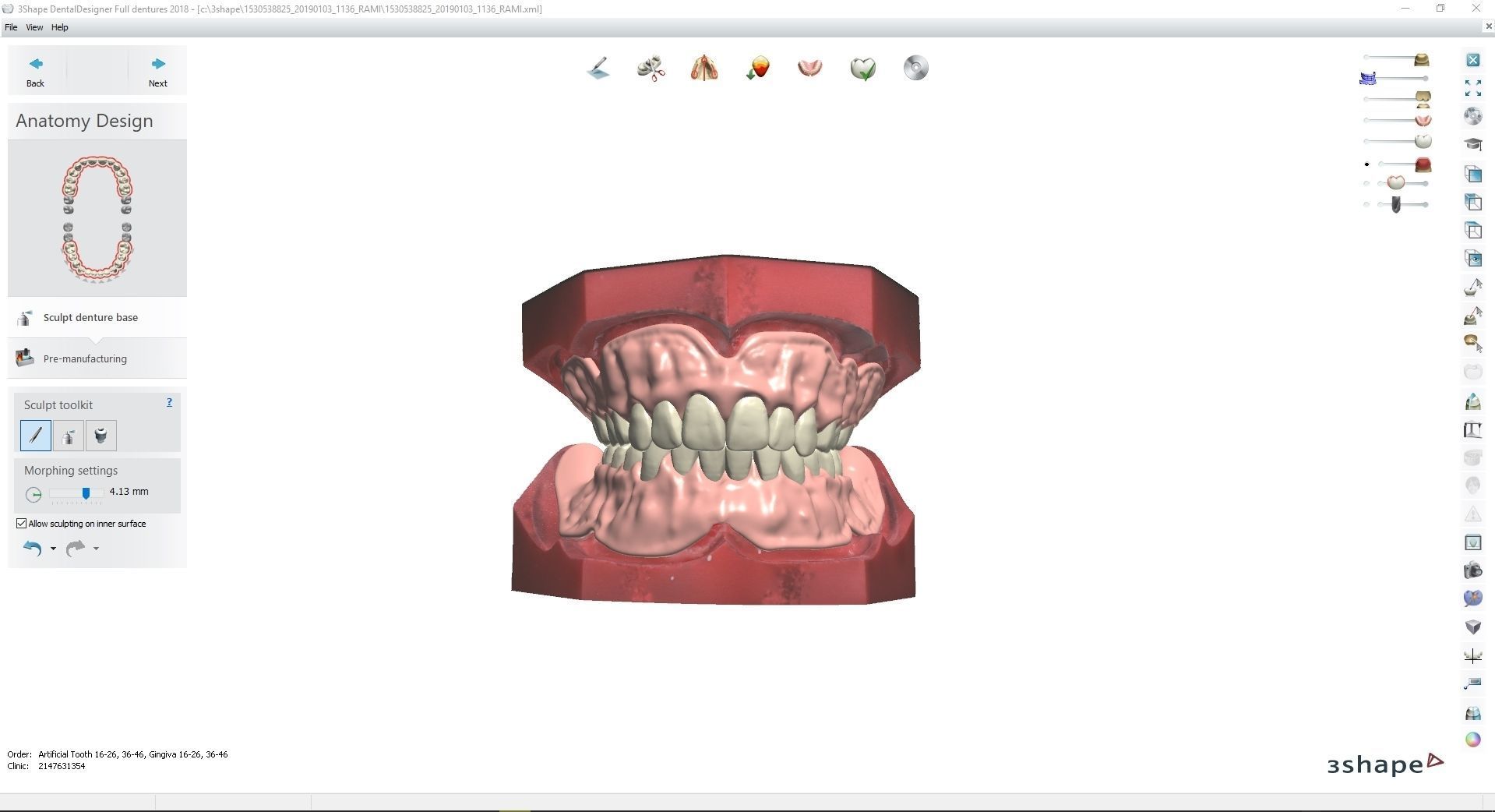 Digital Try-in Full Dentures for Injection Molding  3D print model_2