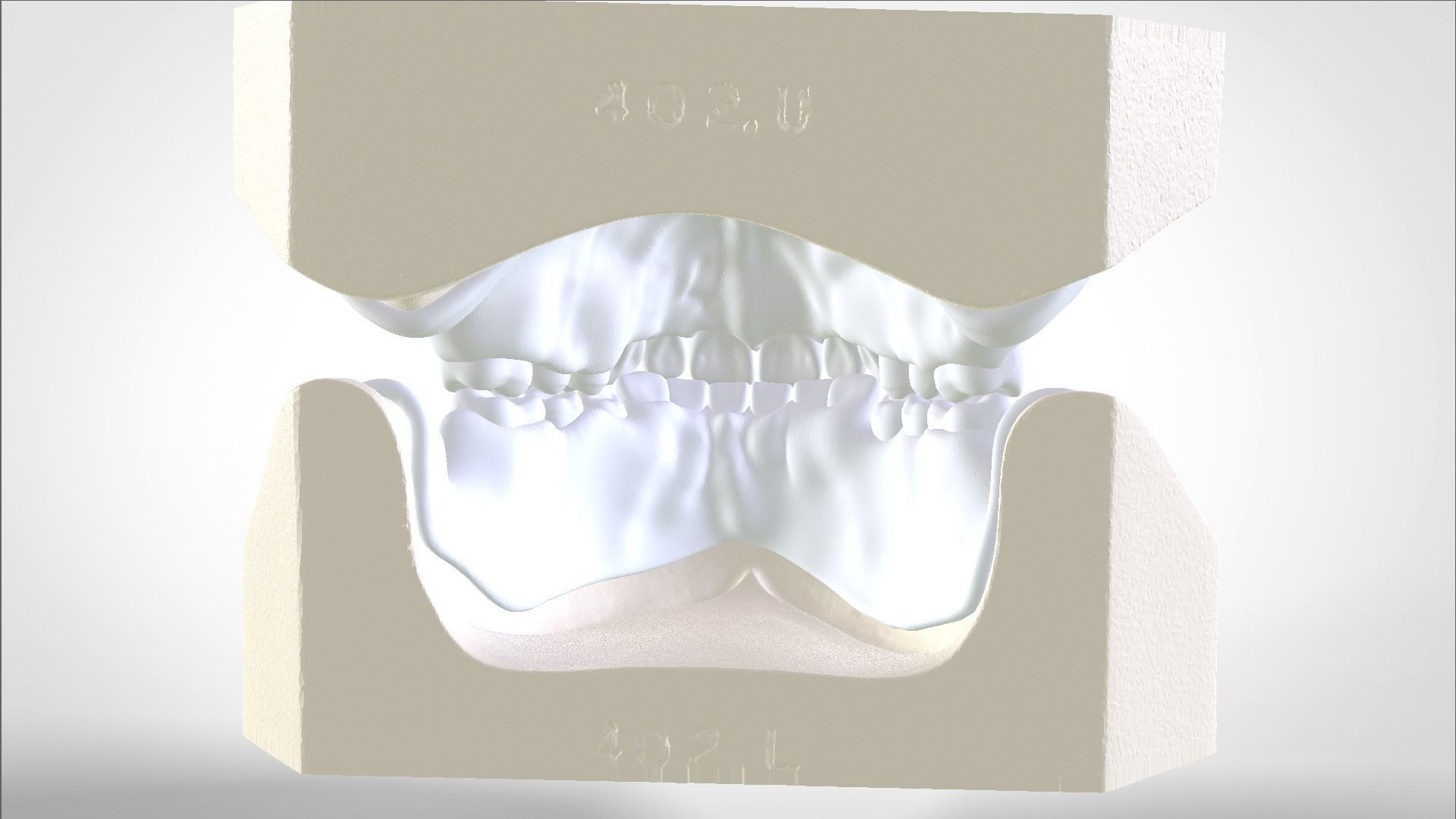 Digital Try-in Full Dentures for Injection Molding  3D print model_8