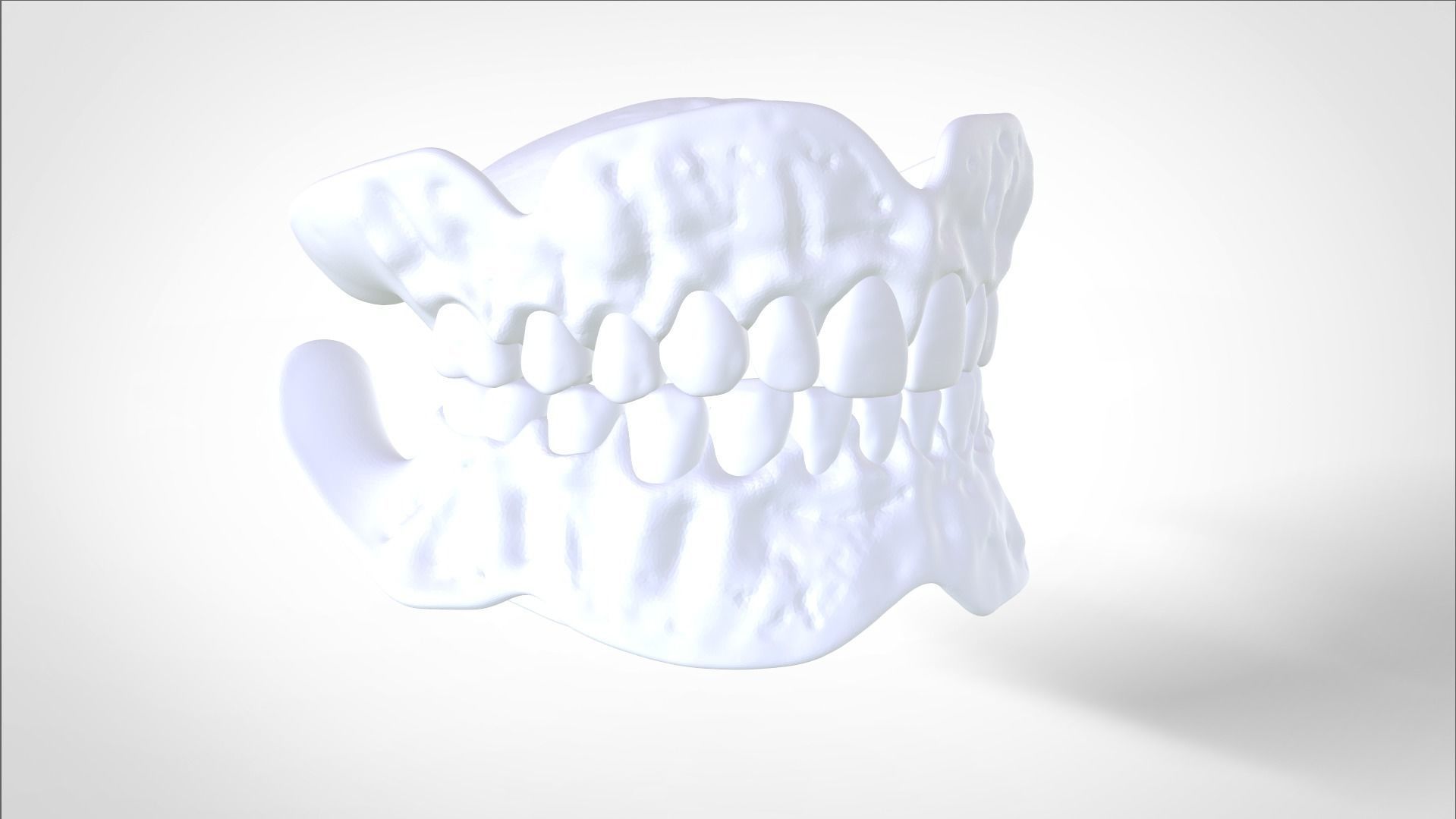 Digital Try-in Full Dentures for Injection Molding  3D print model_19