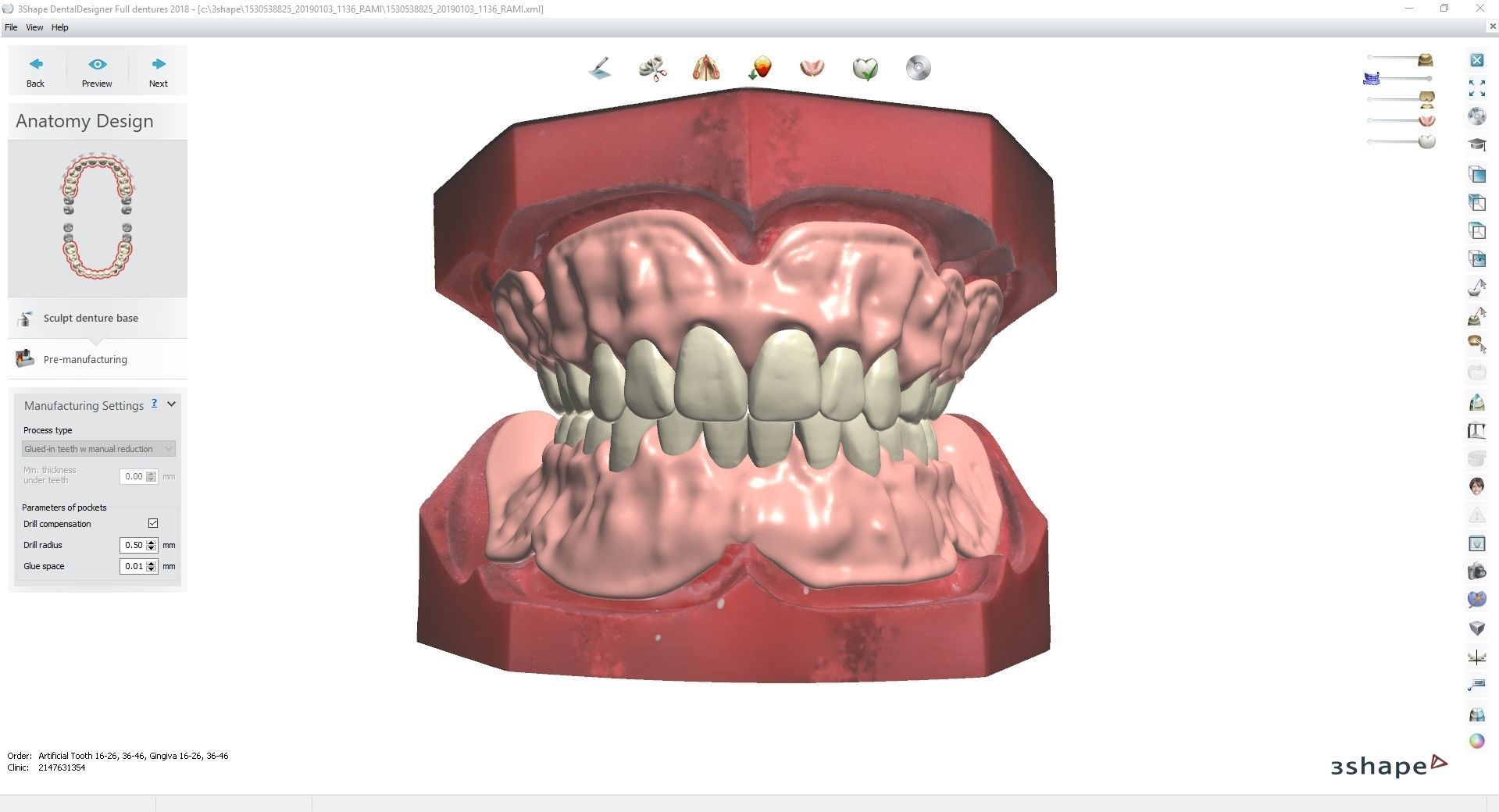 Digital Try-in Full Dentures for Injection Molding  3D print model_11