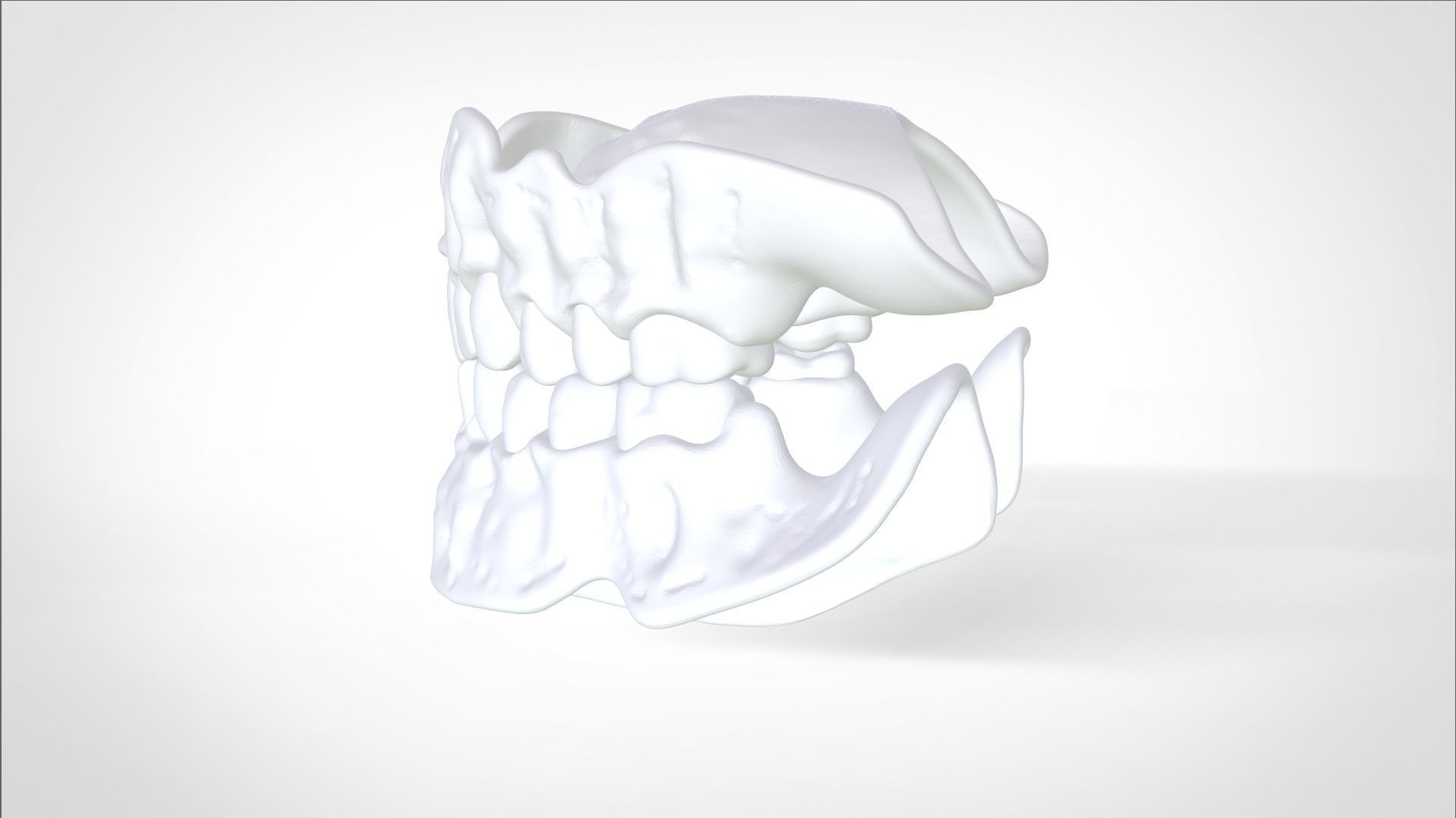 Digital Try-in Full Dentures for Injection Molding  3D print model_21