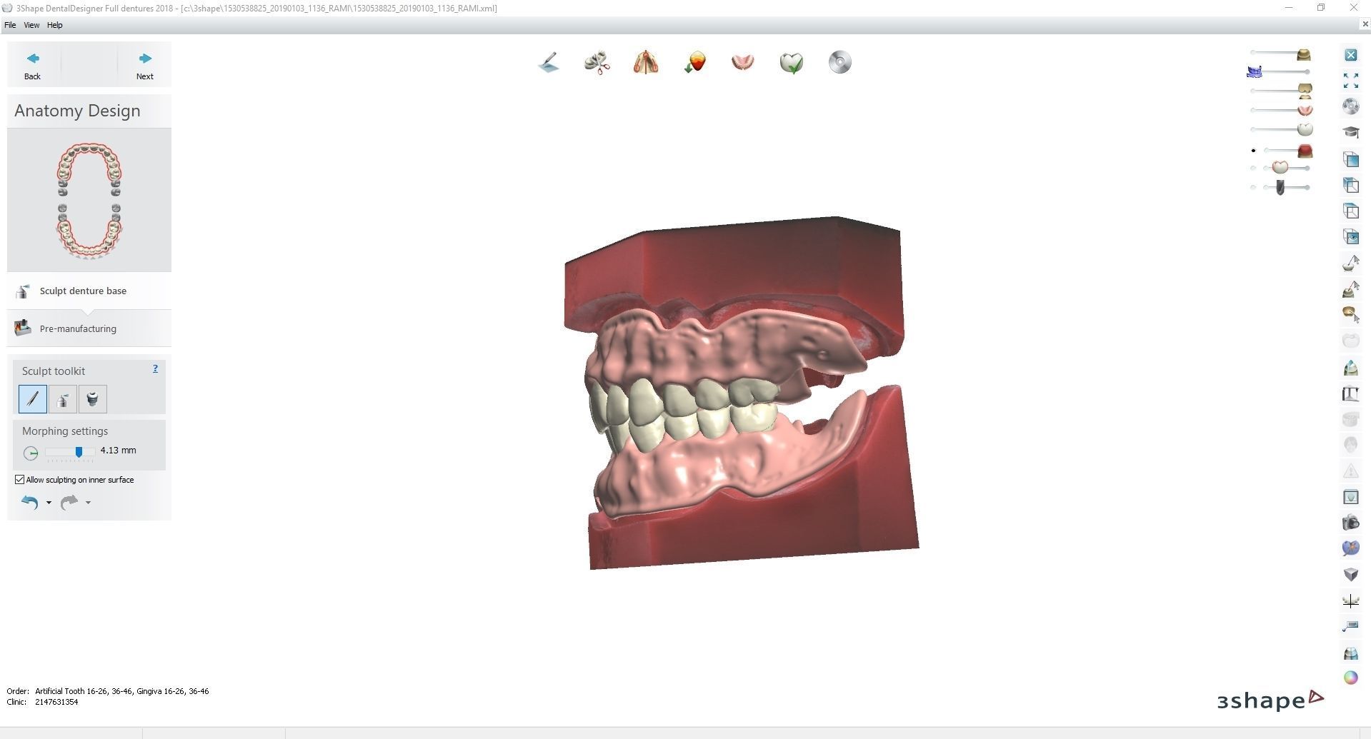 Digital Try-in Full Dentures for Injection Molding  3D print model_5
