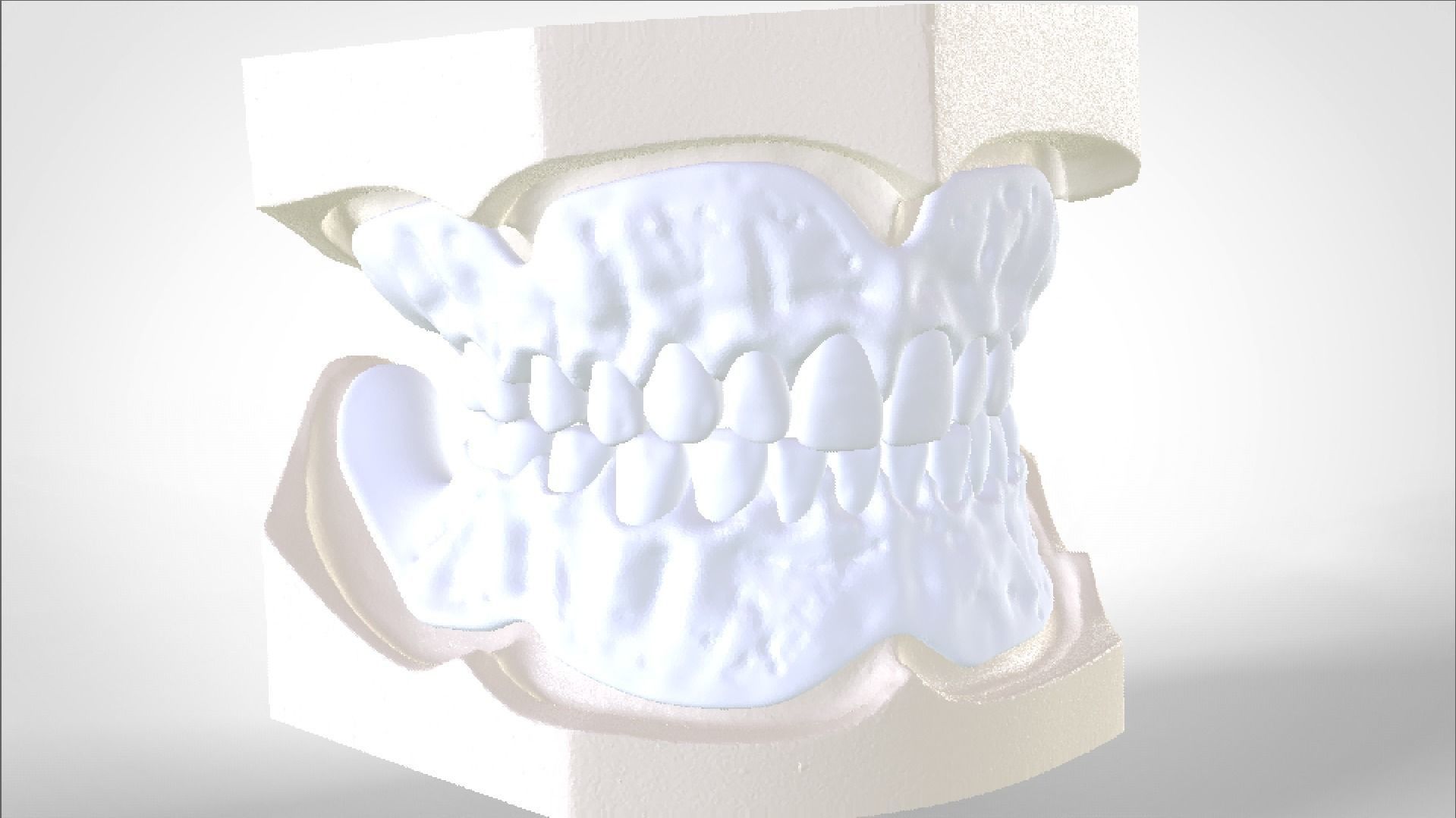 Digital Try-in Full Dentures for Injection Molding  3D print model_14