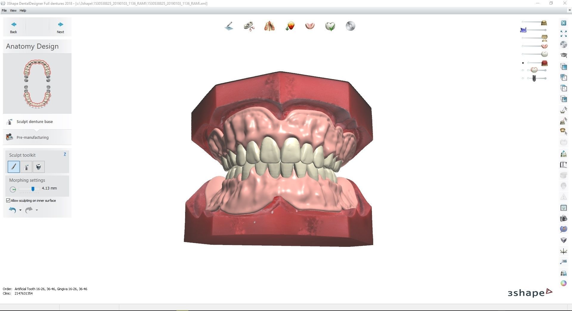 Digital Try-in Full Dentures for Injection Molding  3D print model_9