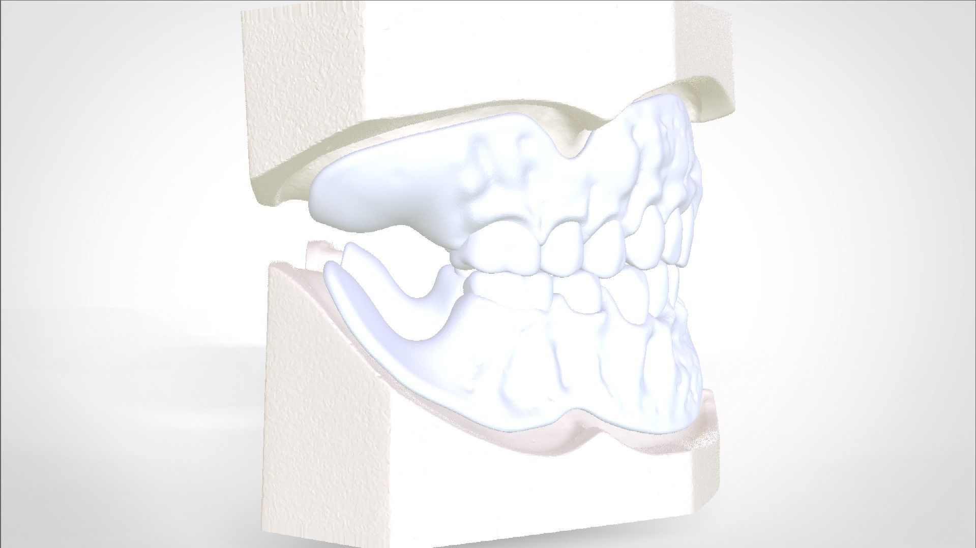 Digital Try-in Full Dentures for Injection Molding  3D print model_10