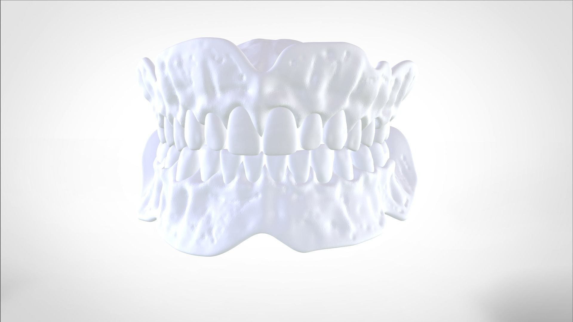 Digital Try-in Full Dentures for Injection Molding  3D print model_18