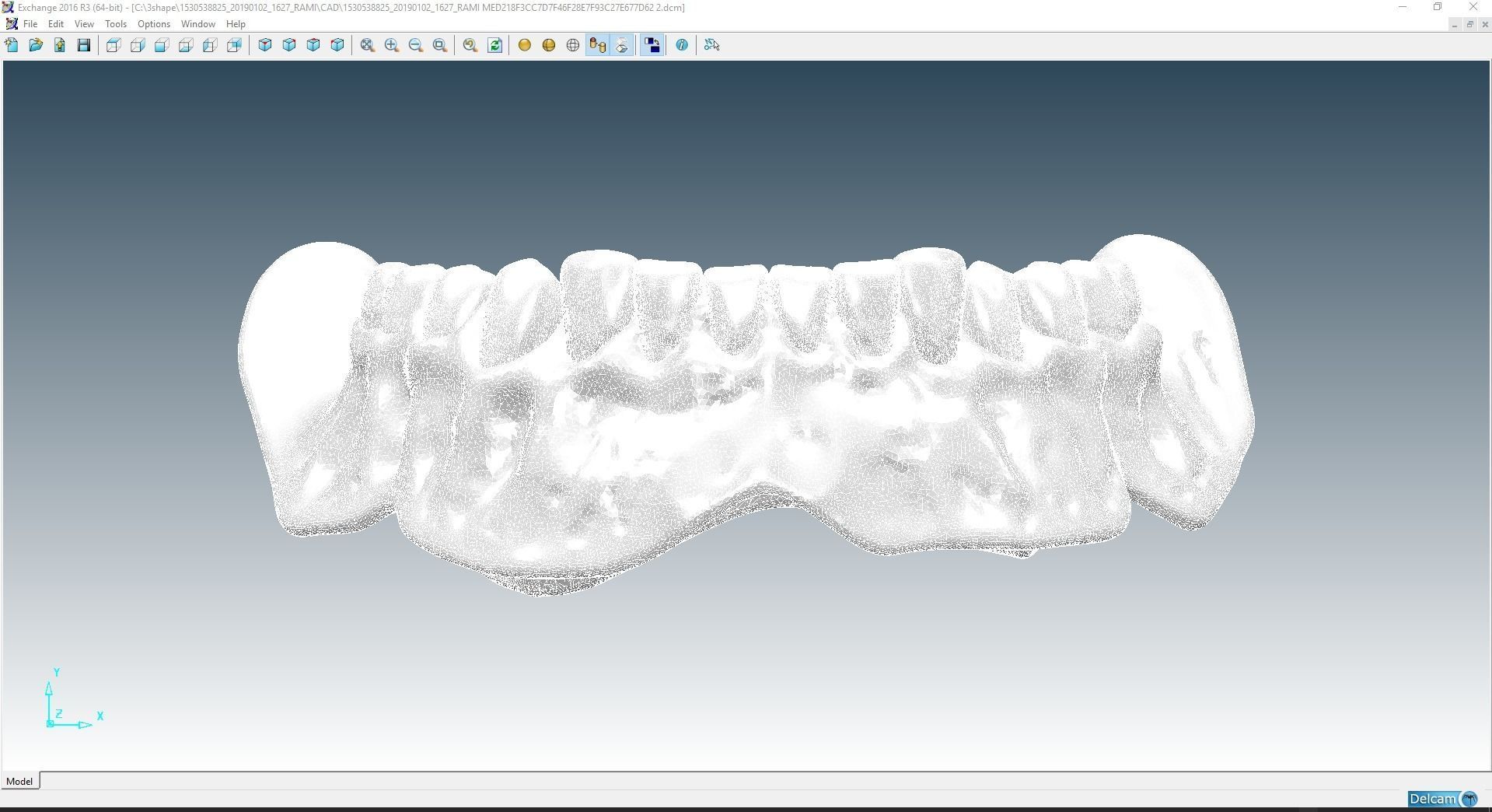 Digital Try-in Full Dentures for Injection Molding  3D print model_17