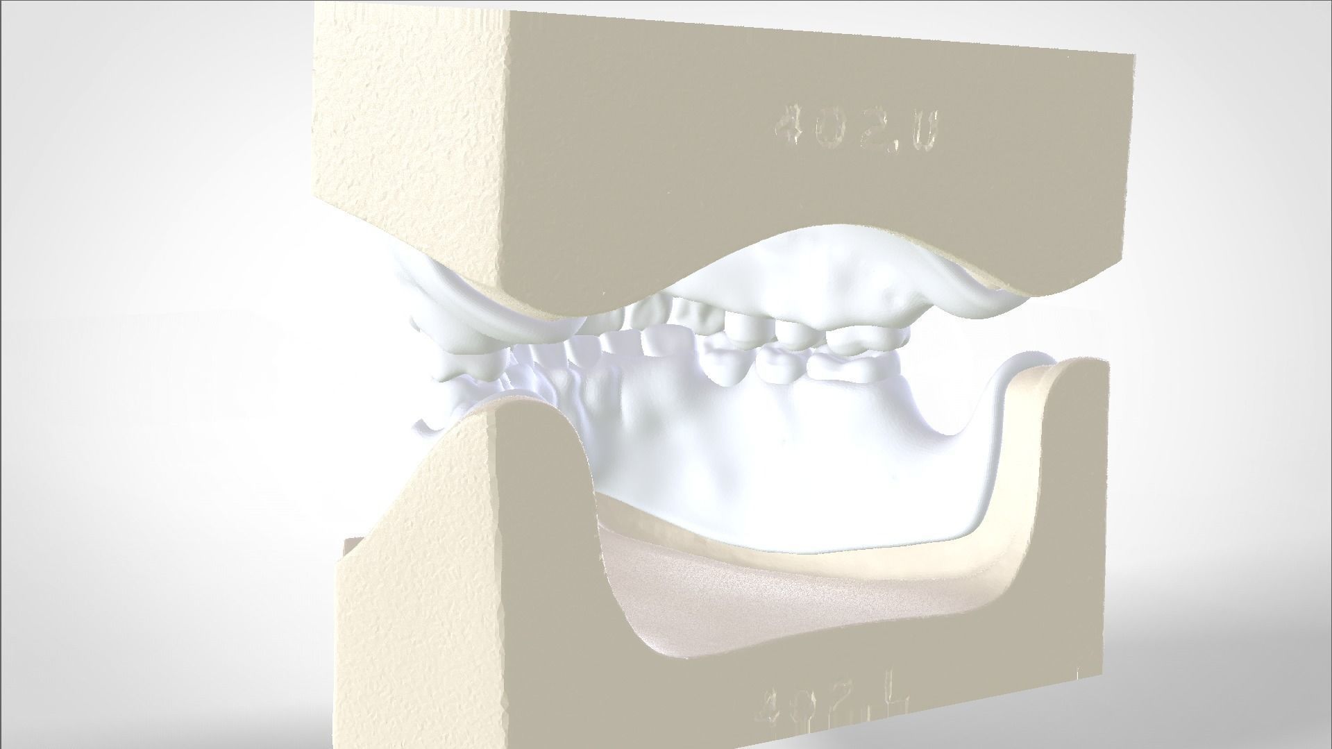 Digital Try-in Full Dentures for Injection Molding  3D print model_6