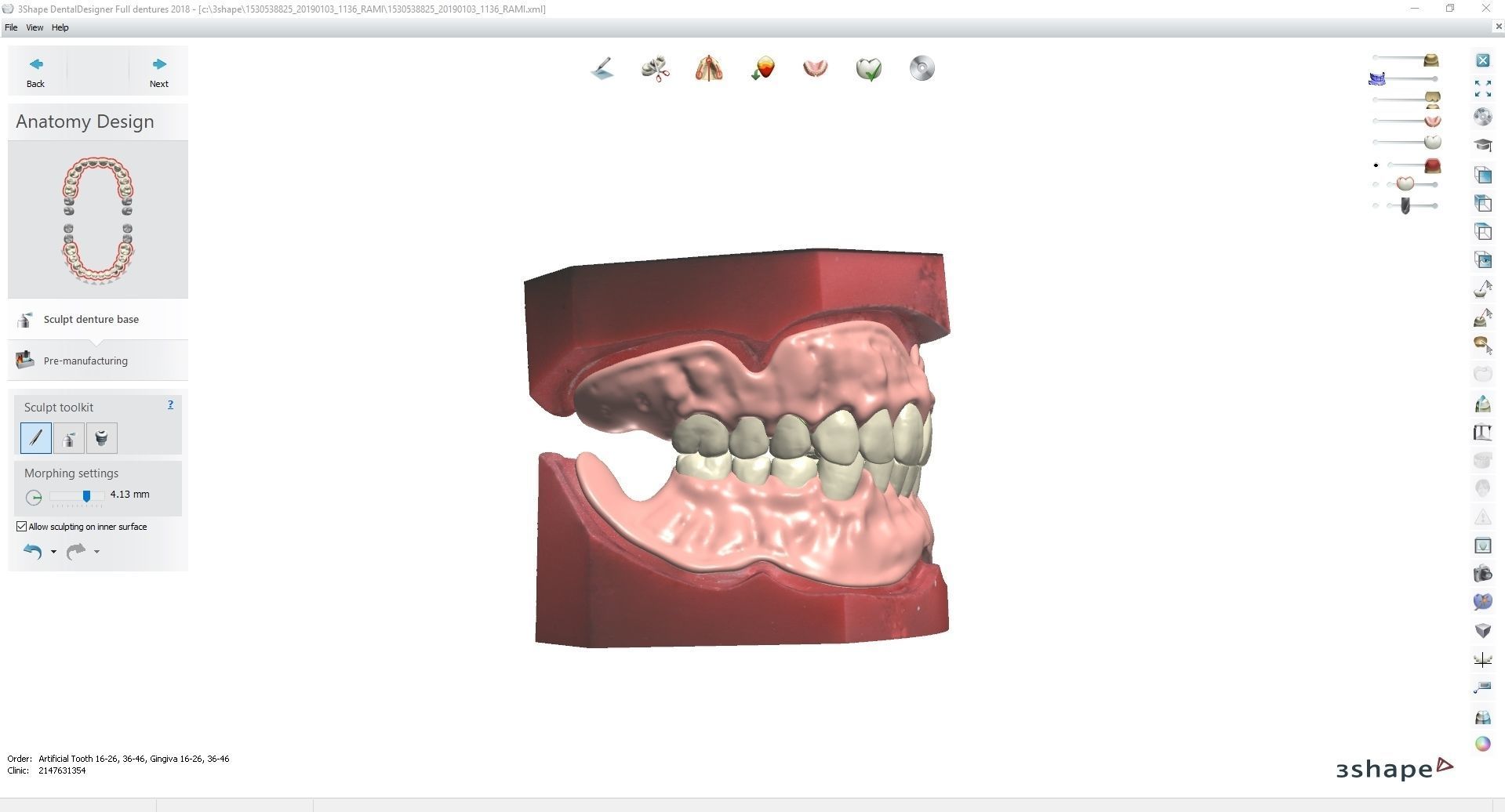 Digital Try-in Full Dentures for Injection Molding  3D print model_3