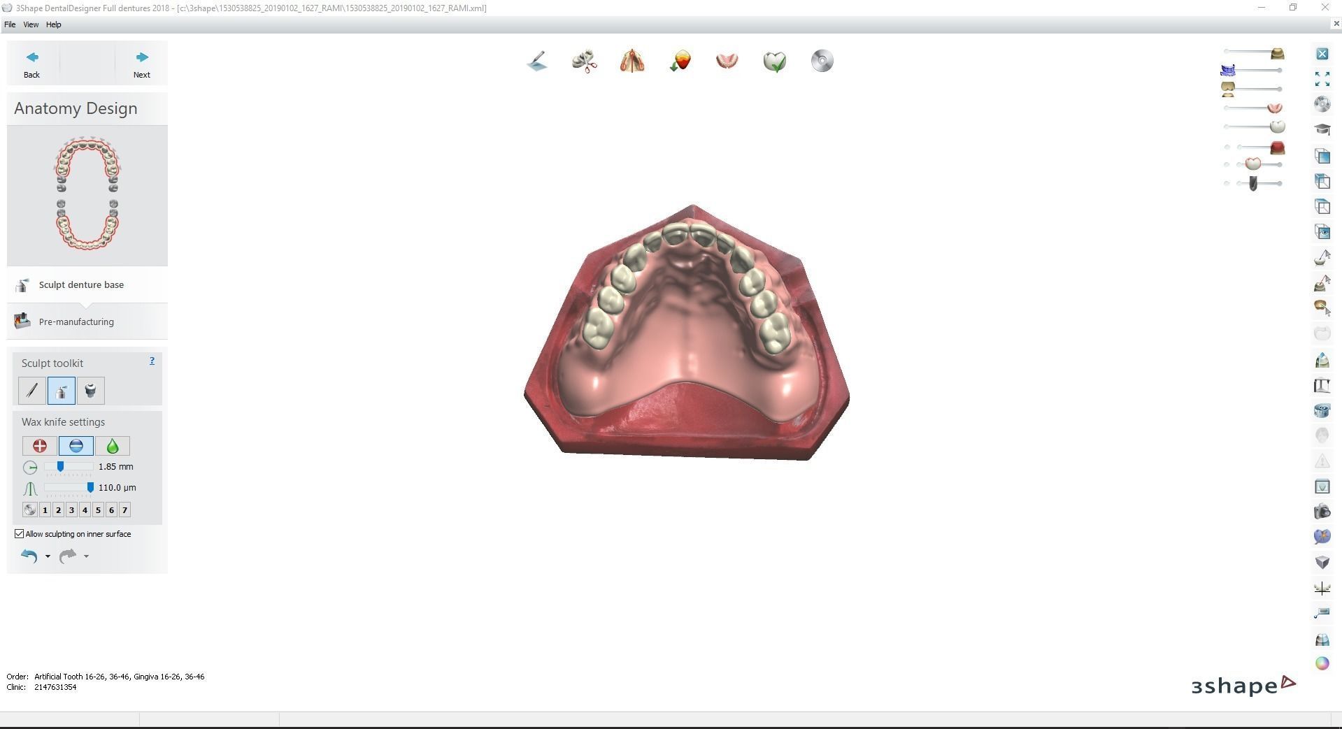 Digital Try-in Full Dentures for Injection Molding  3D print model_15