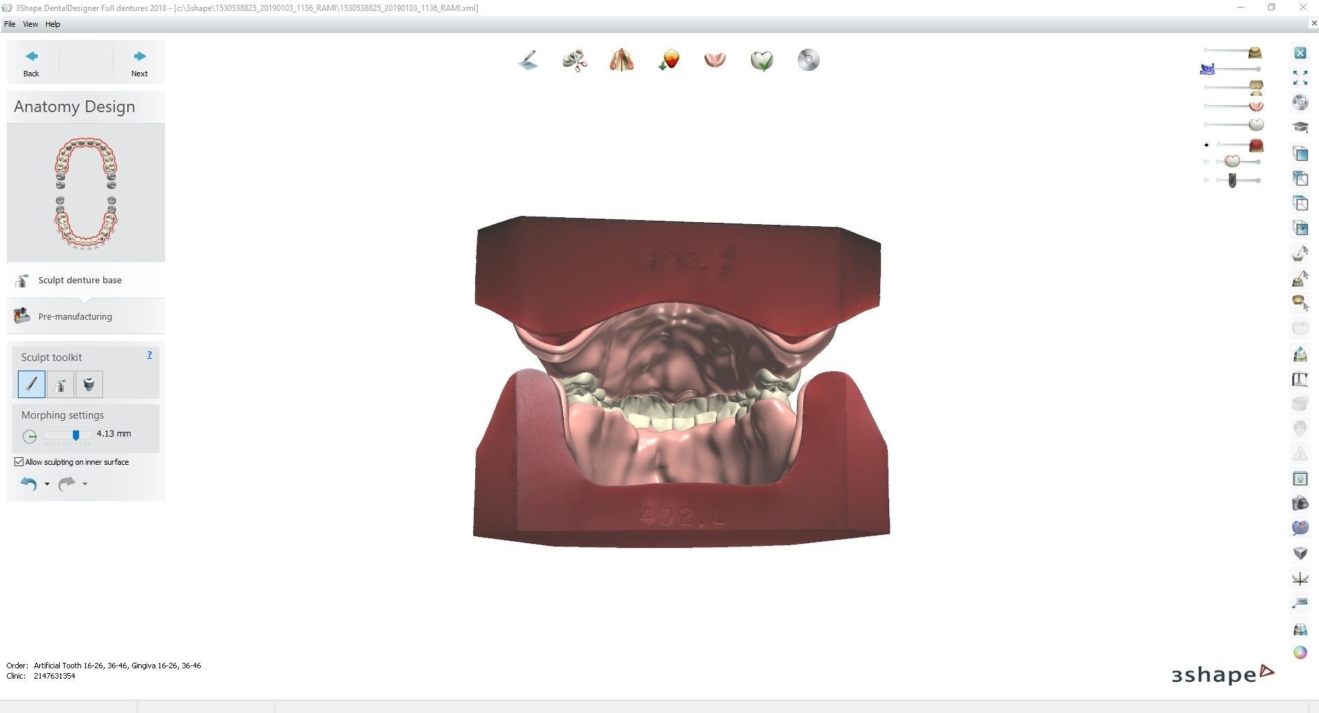 Digital Try-in Full Dentures for Injection Molding  3D print model_7