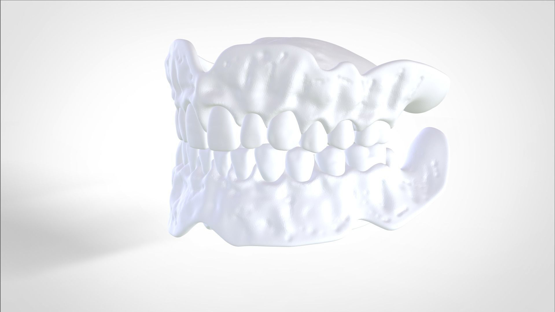 Digital Try-in Full Dentures for Injection Molding  3D print model_20