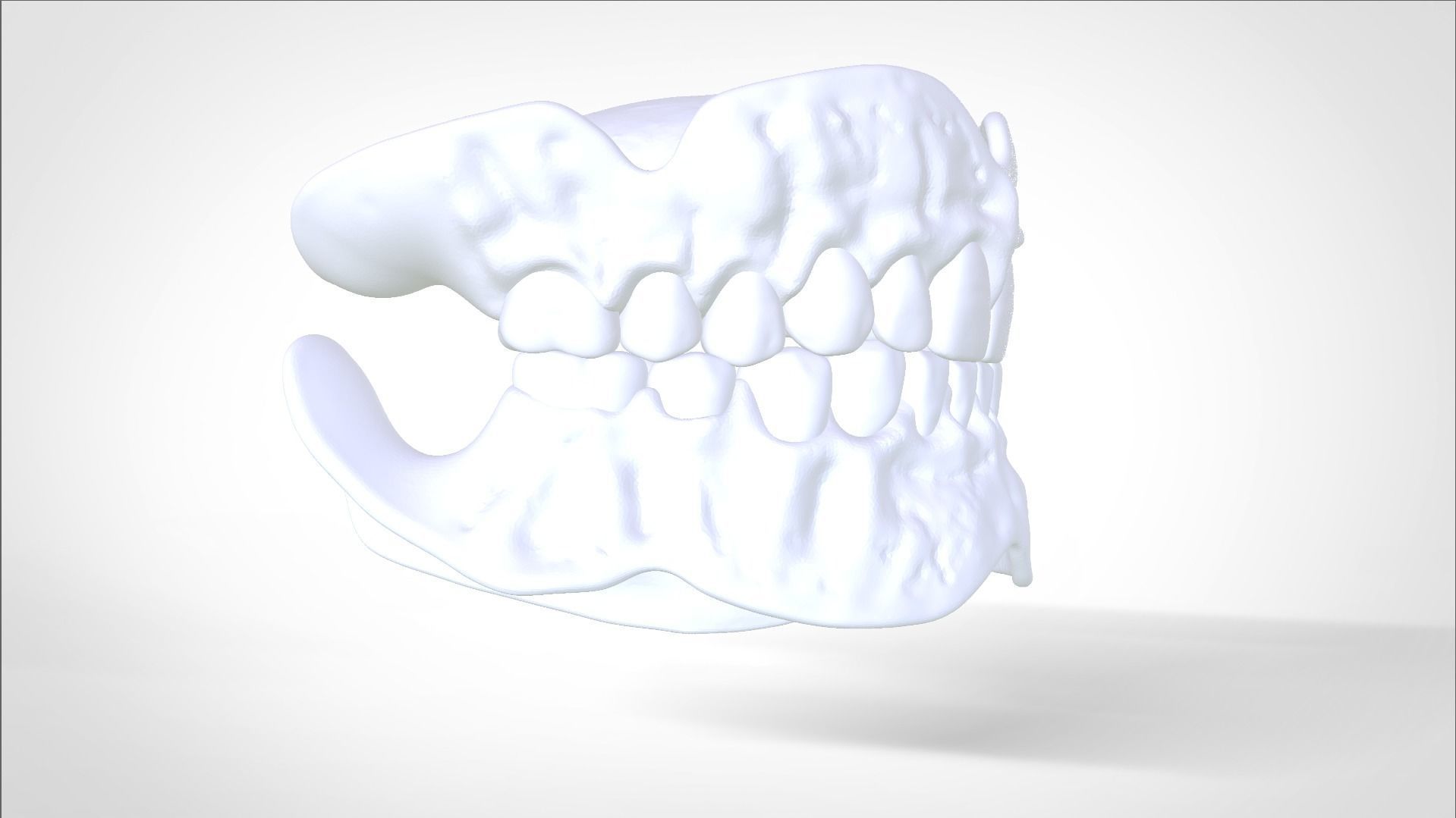 Digital Try-in Full Dentures for Injection Molding  3D print model_23