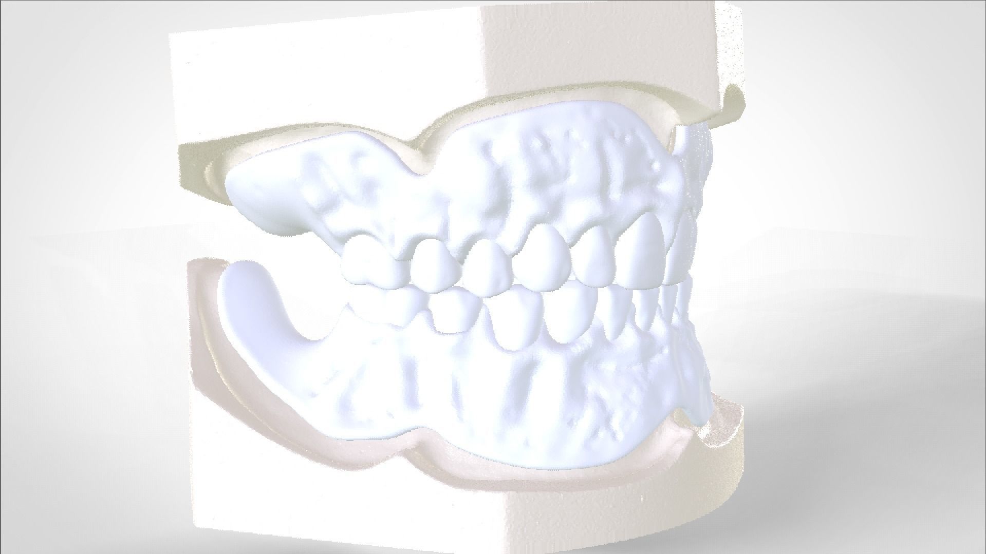 Digital Try-in Full Dentures for Injection Molding  3D print model_12