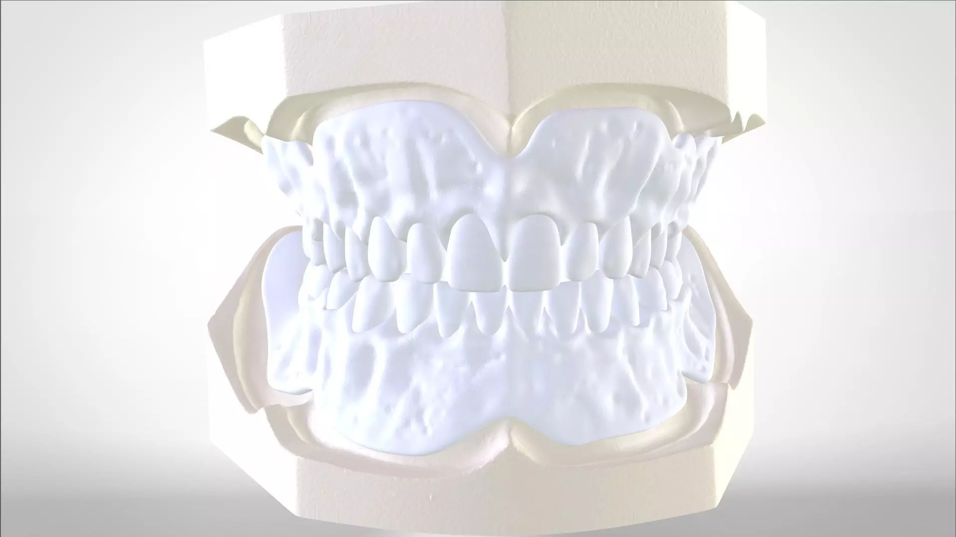 Digital Try-in Full Dentures for Injection Molding  3D print model_0
