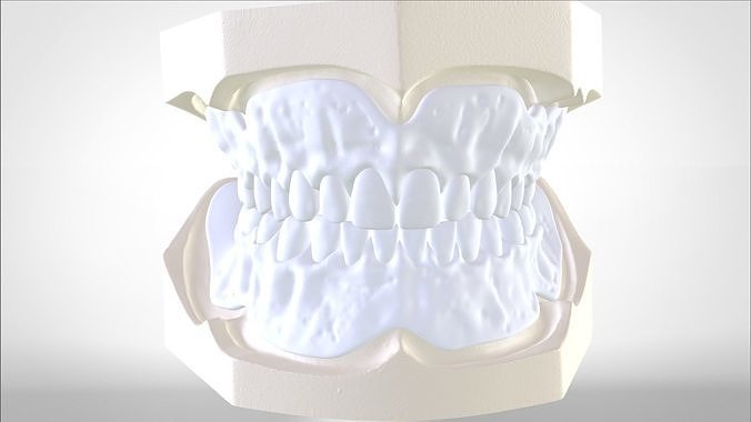 Digital Try-in Full Dentures for Injection Molding  3D print model