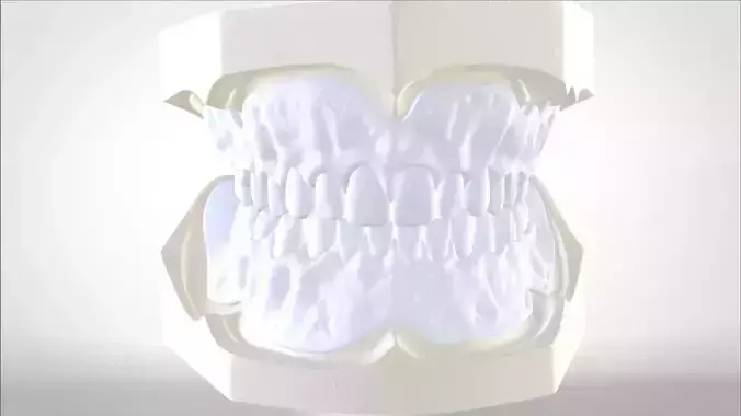 Digital Try-in Full Dentures for Injection Molding  3D print model
