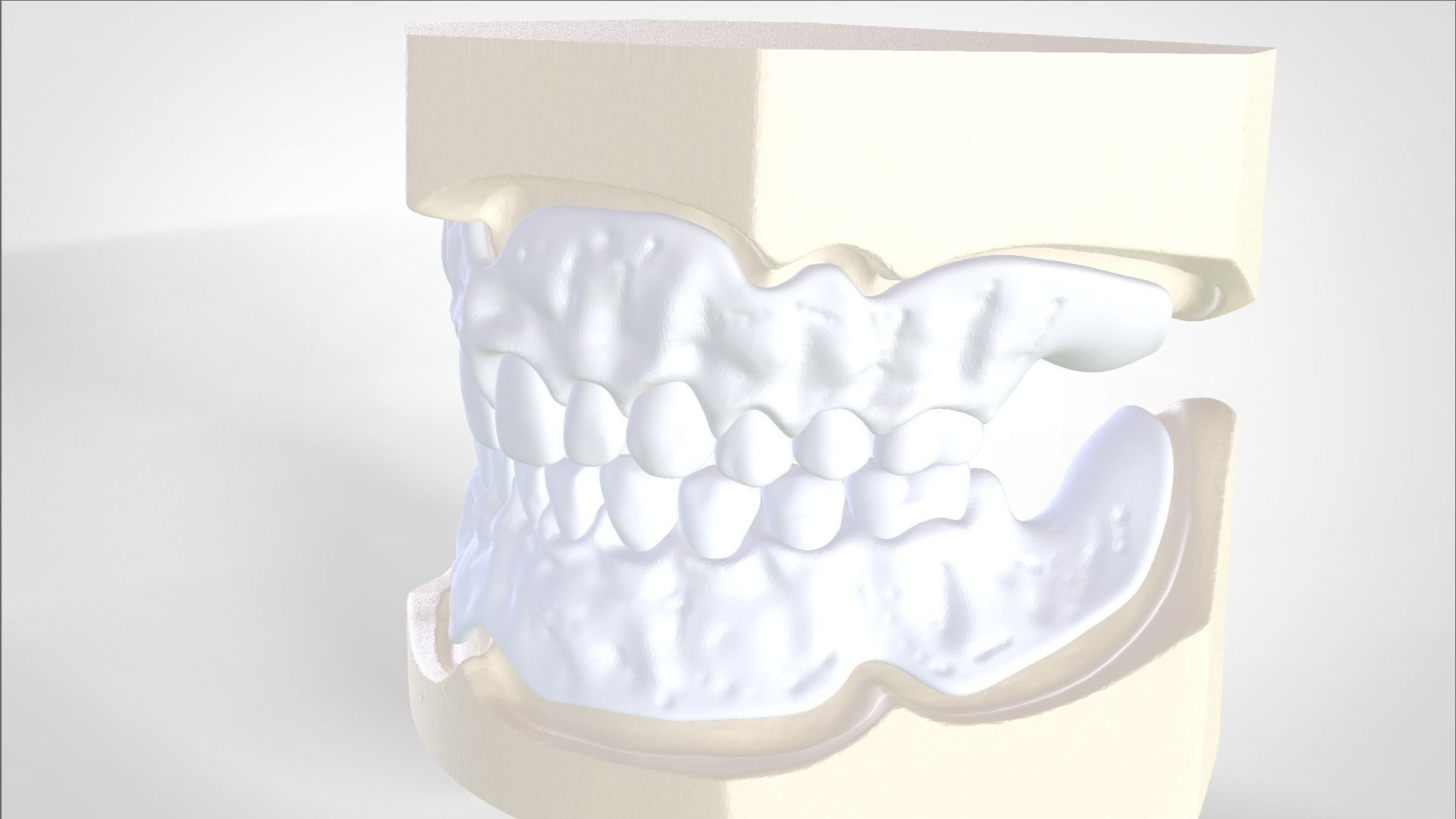 Digital Try-in Full Dentures for Injection Molding  3D print model_4