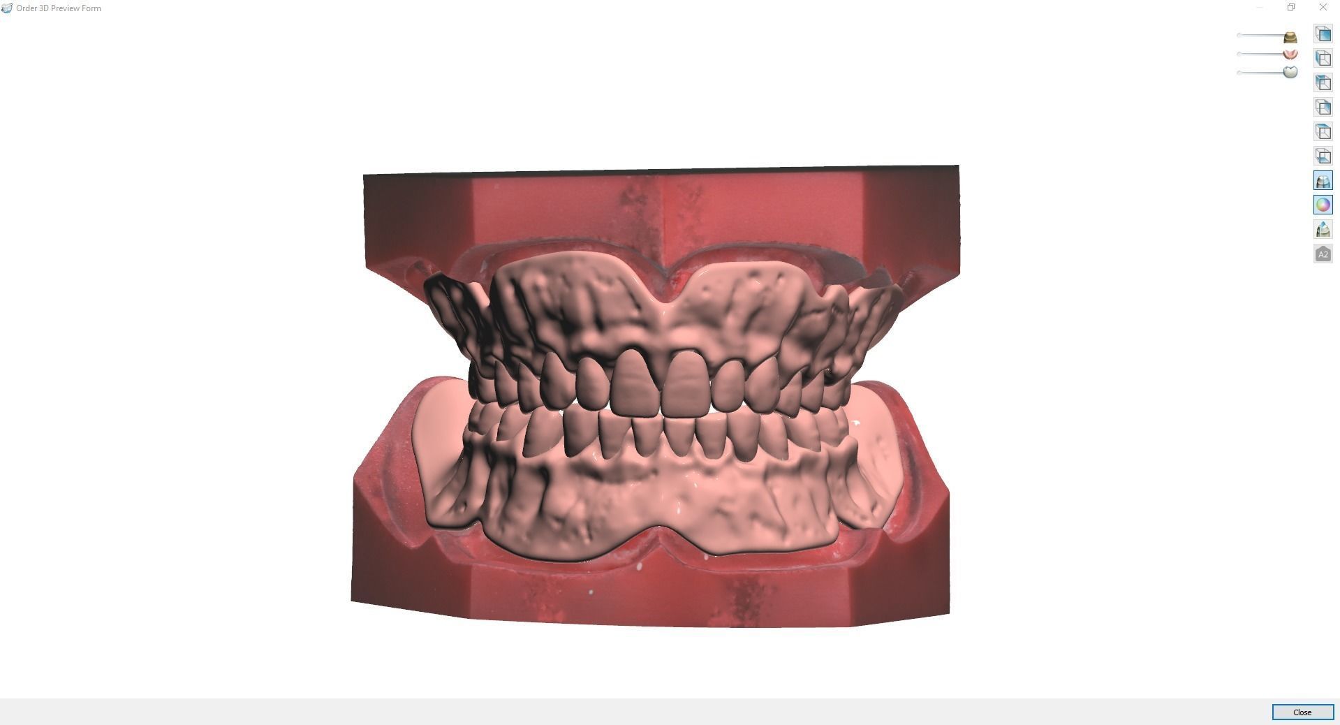 Digital Try-in Full Dentures for Injection Molding  3D print model_16