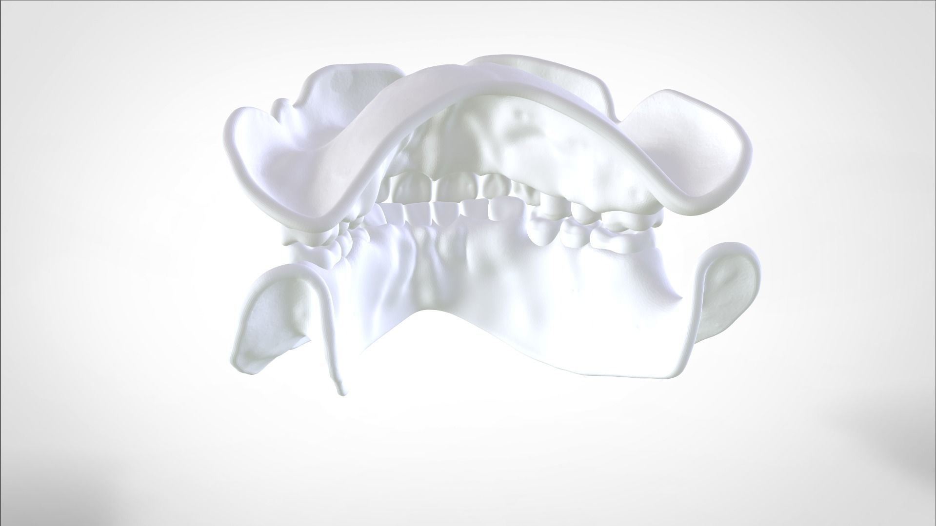 Digital Try-in Full Dentures for Injection Molding  3D print model_22