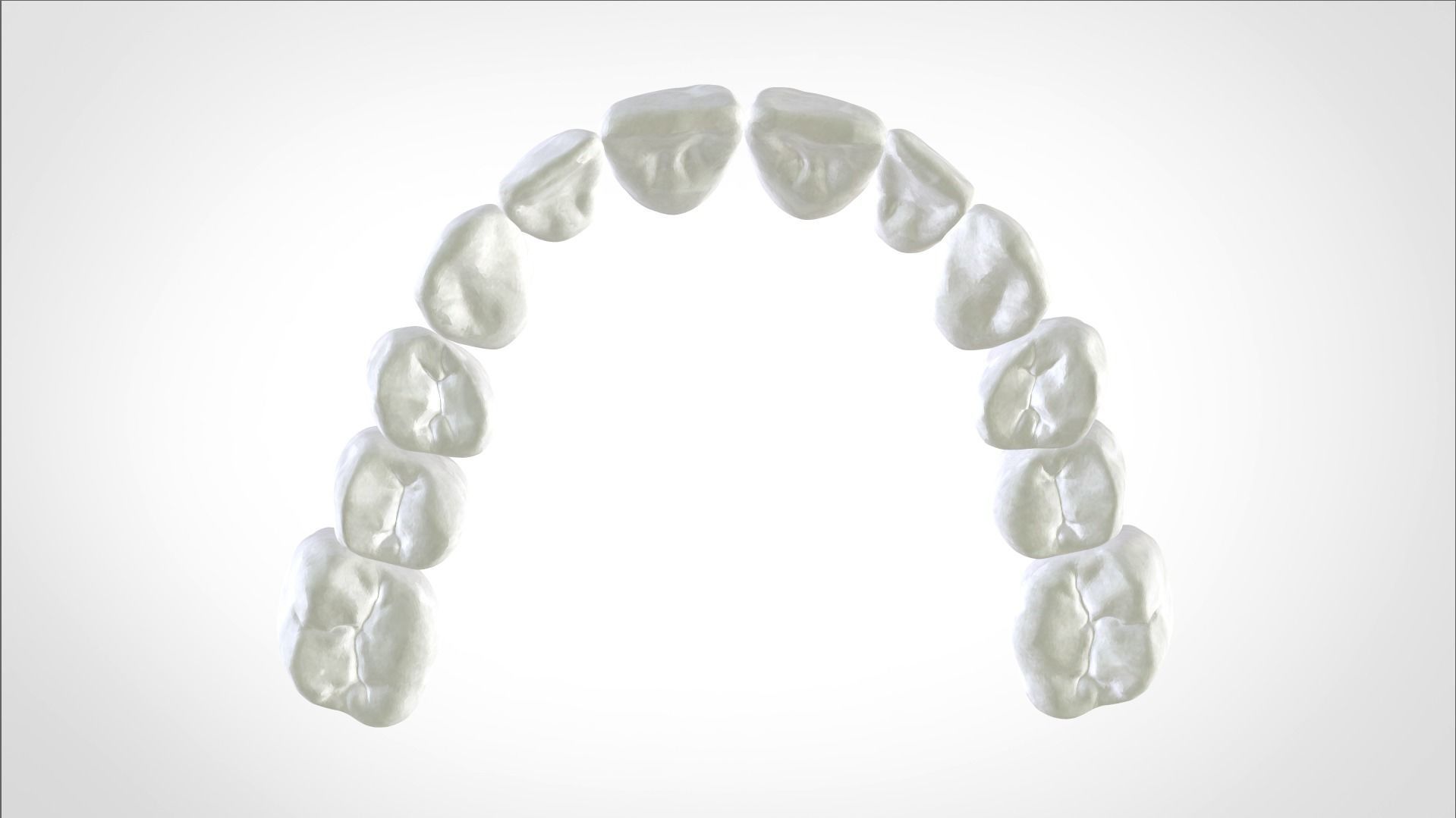 Digital Full Dentures for Gluedin Teeth with Manual Reduction 3D print model_19