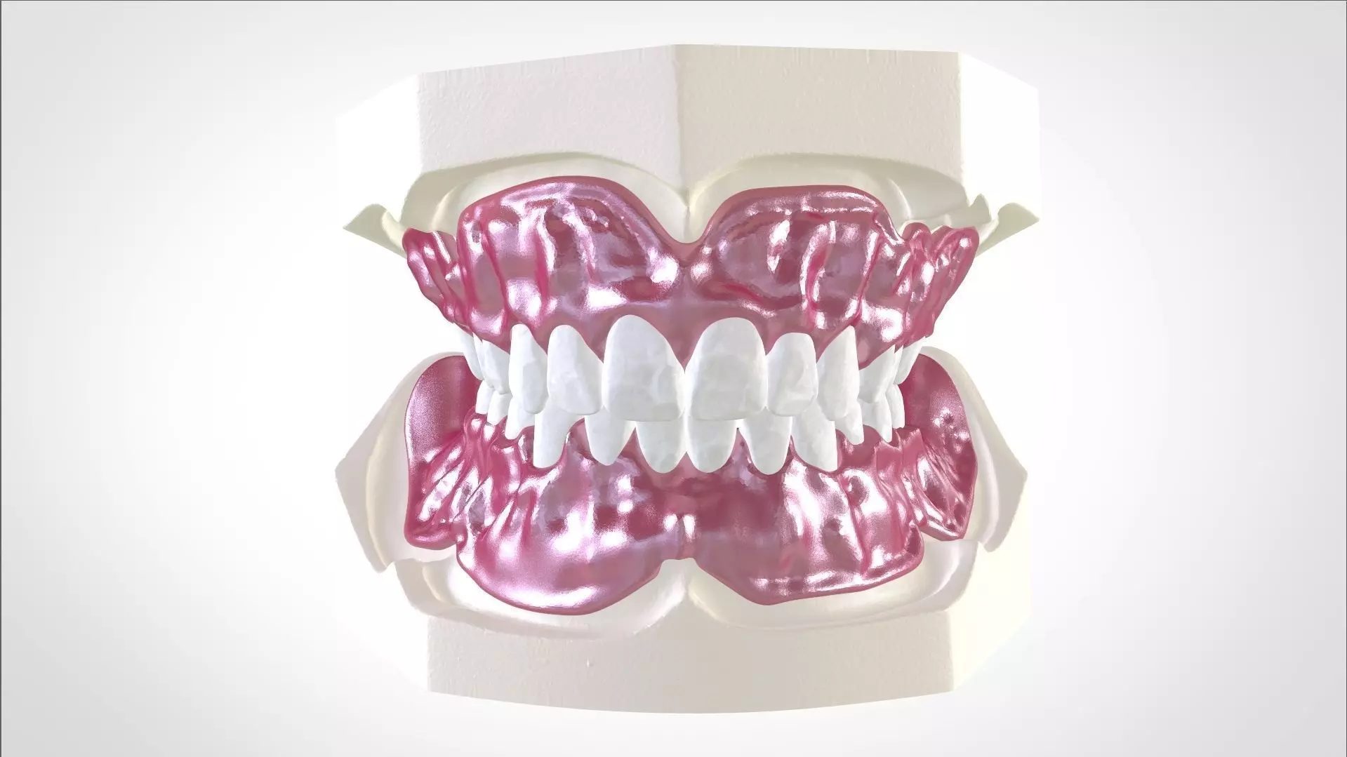 Digital Full Dentures for Gluedin Teeth with Manual Reduction 3D print model_0