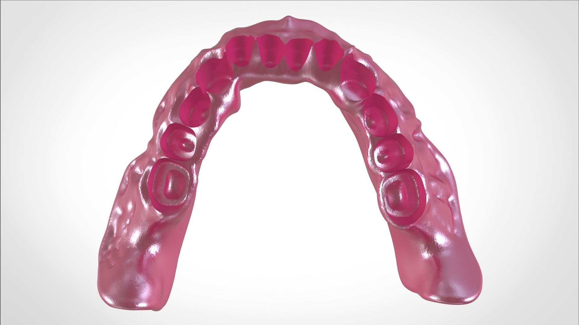 Digital Full Dentures for Gluedin Teeth with Manual Reduction 3D print model_33