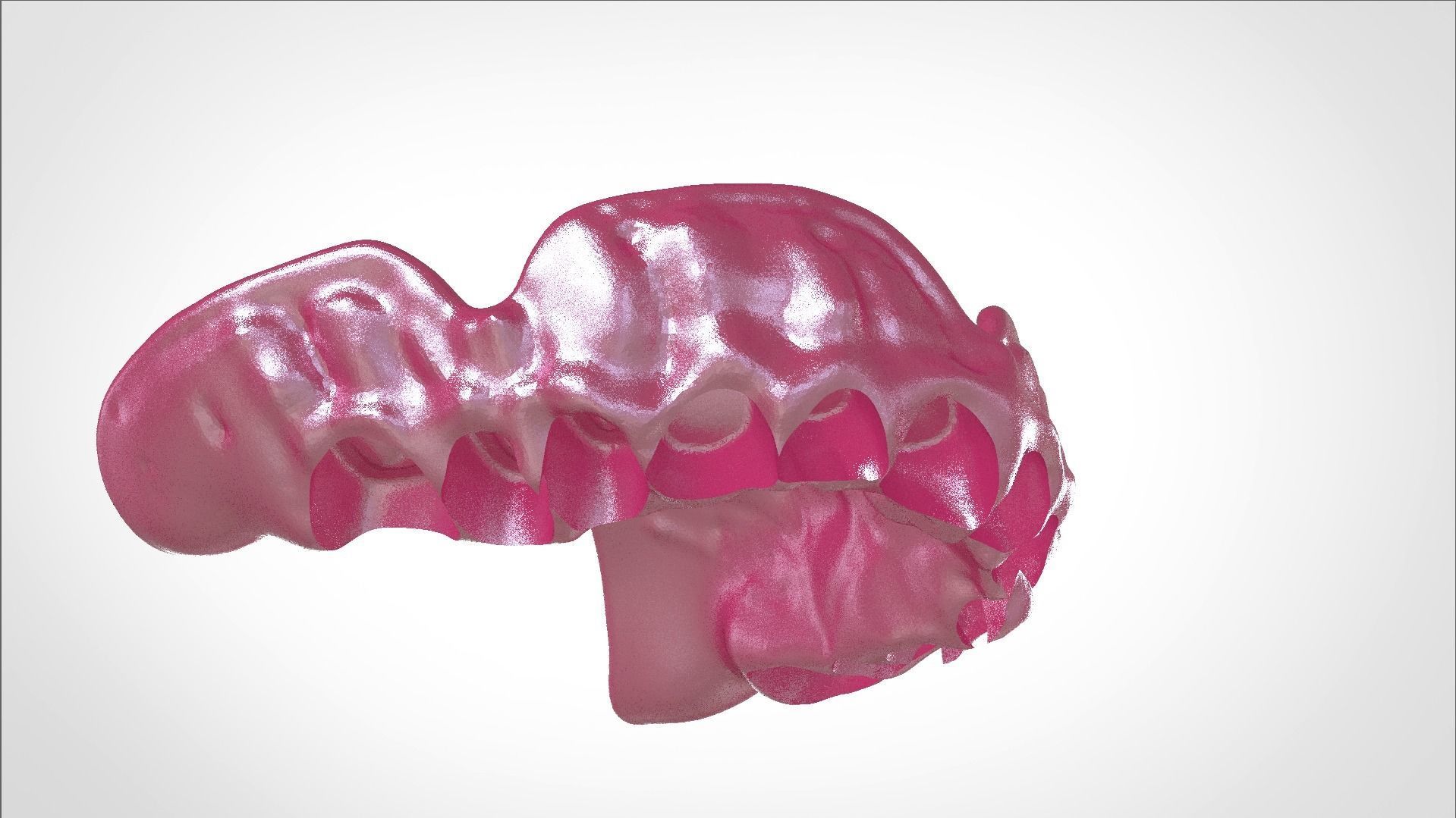 Digital Full Dentures for Gluedin Teeth with Manual Reduction 3D print model_22