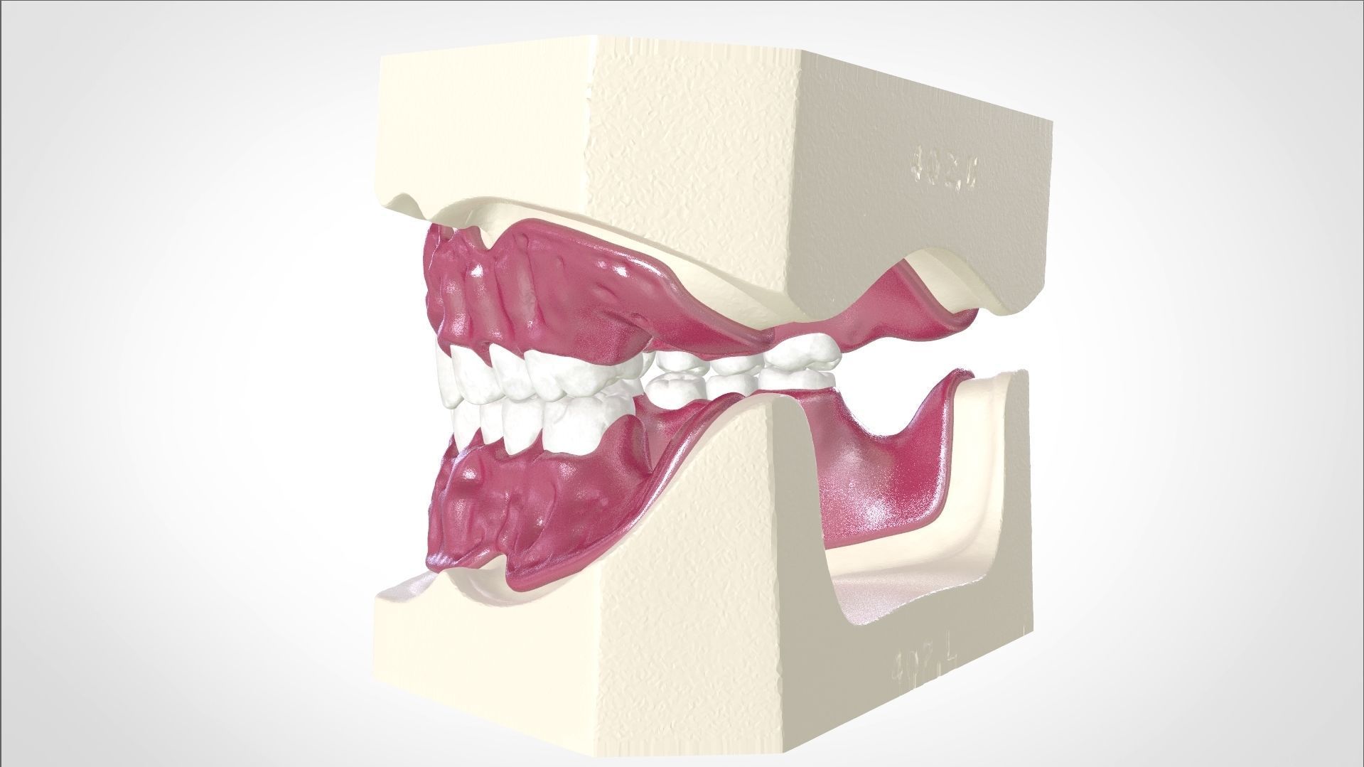 Digital Full Dentures for Gluedin Teeth with Manual Reduction 3D print model_7