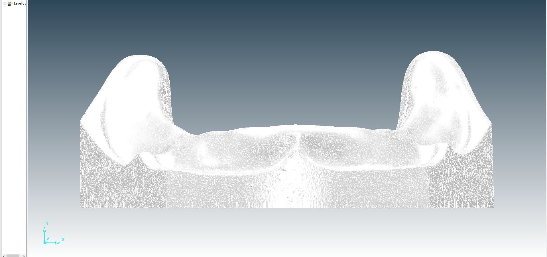 Digital Full Dentures for Gluedin Teeth with Manual Reduction 3D print model_29