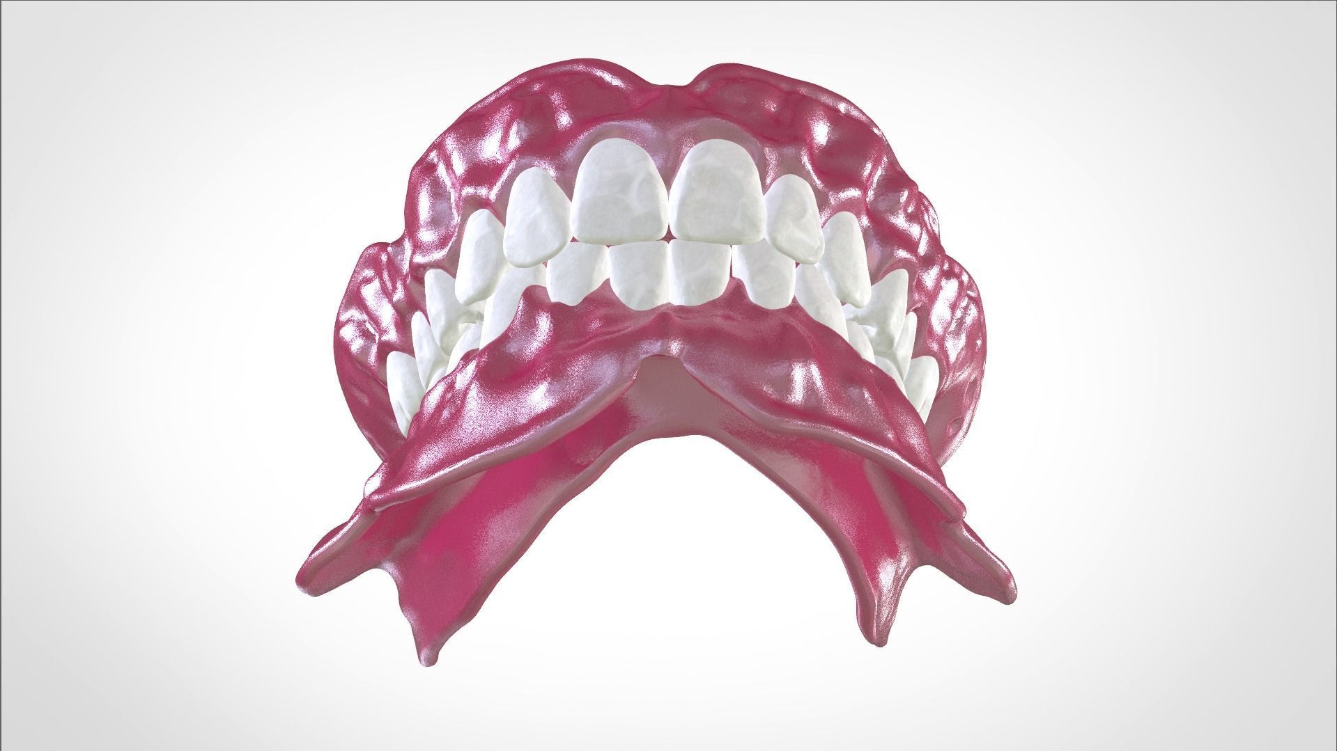 Digital Full Dentures for Gluedin Teeth with Manual Reduction 3D print model_27