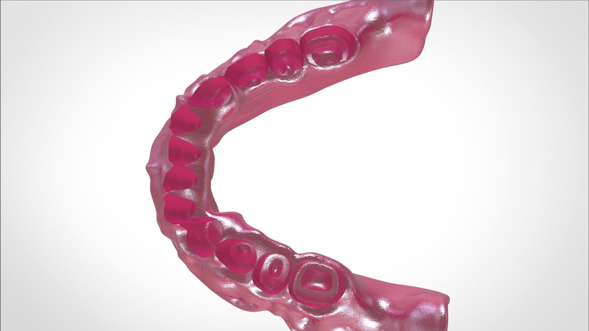 Digital Full Dentures for Gluedin Teeth with Manual Reduction 3D print model_18