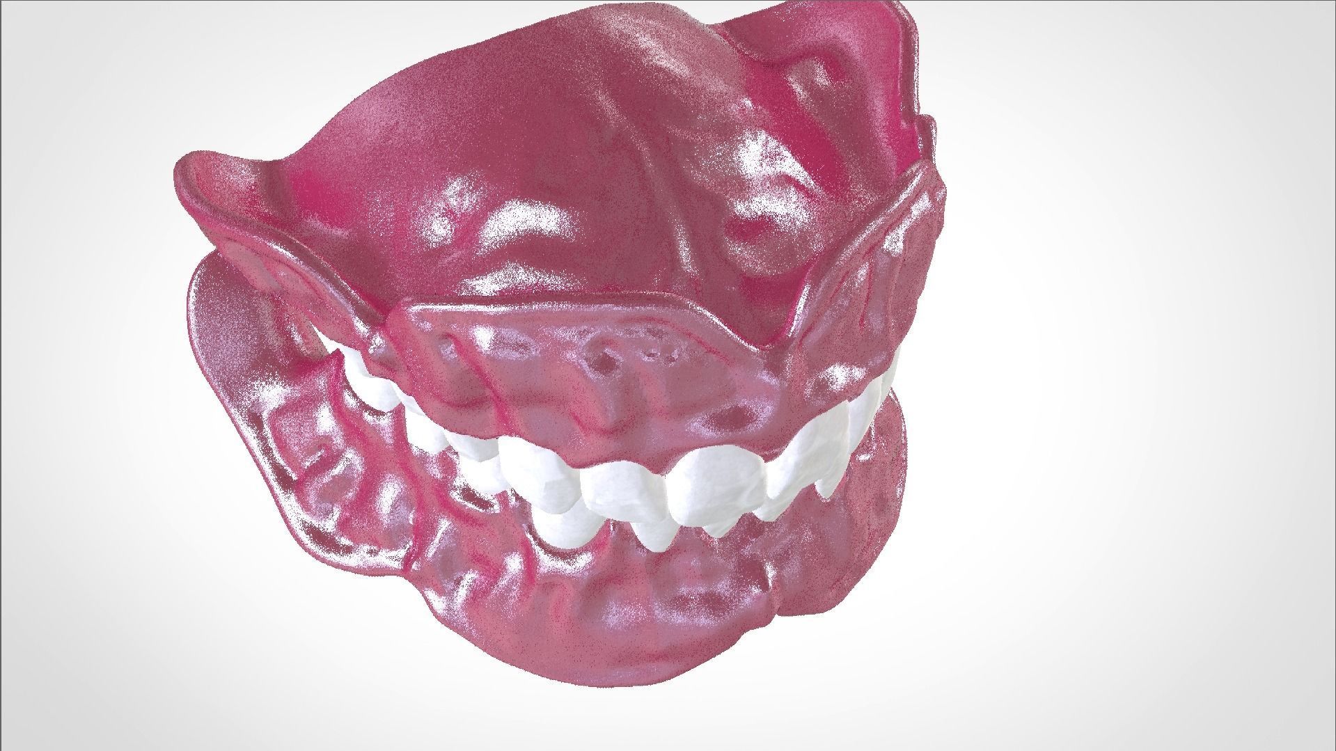 Digital Full Dentures for Gluedin Teeth with Manual Reduction 3D print model_28