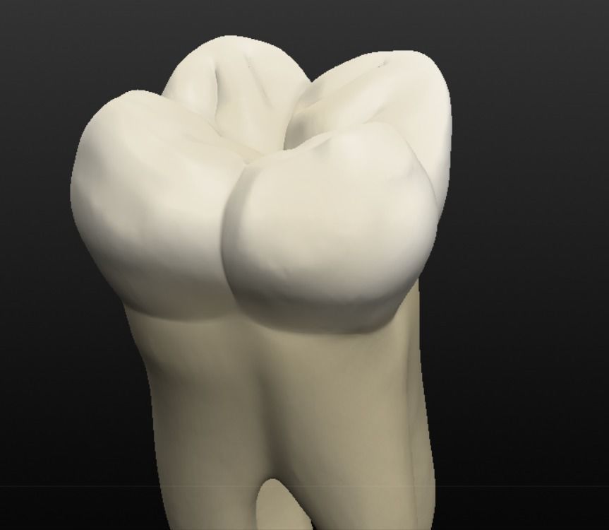 Tooth molar 3D model_5