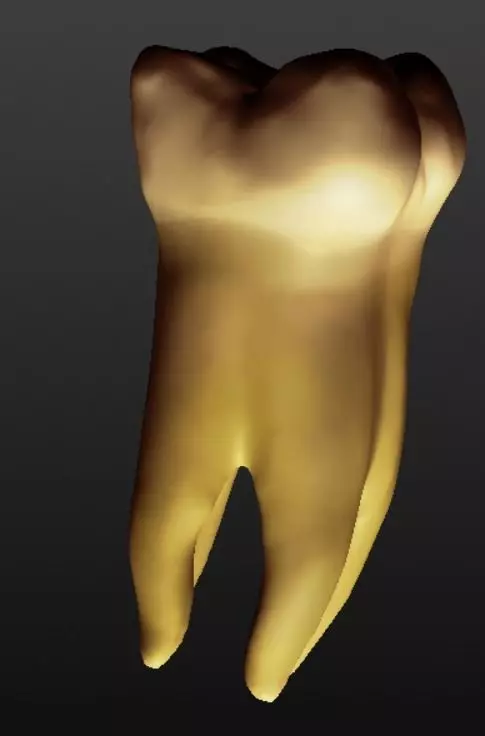 Tooth molar 3D model_0