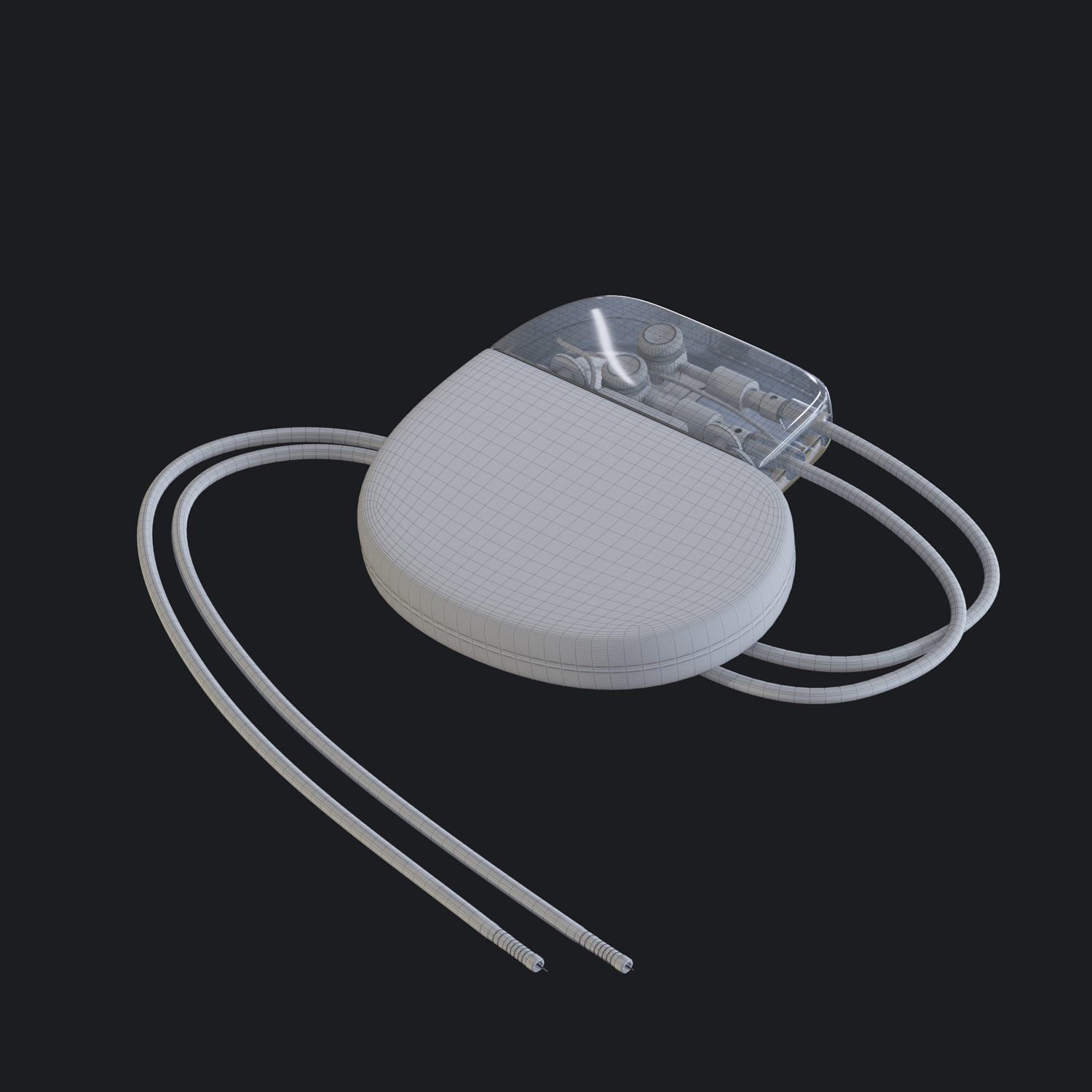 Cardiac Pacemaker 3D model_4