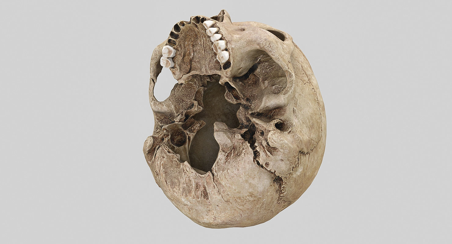 3D Real Human Skull 3D Scan  3D model_11